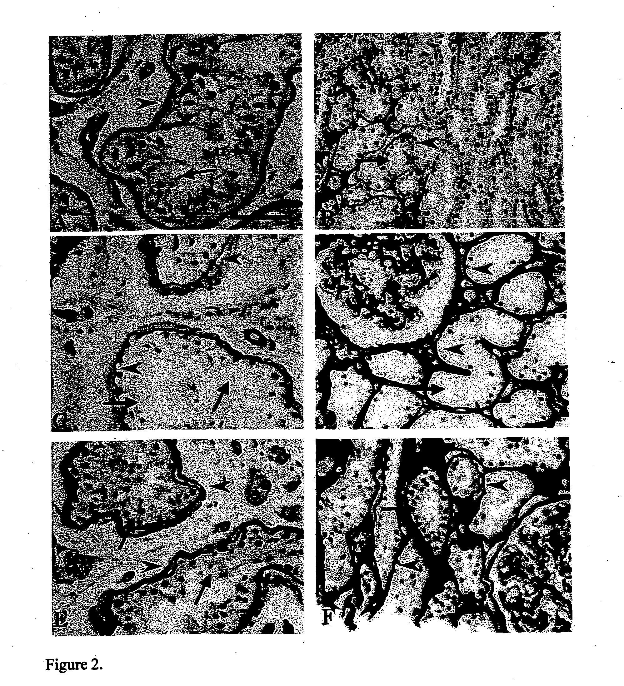 Method for immunohistochemical detection of collagen in a tissue sample