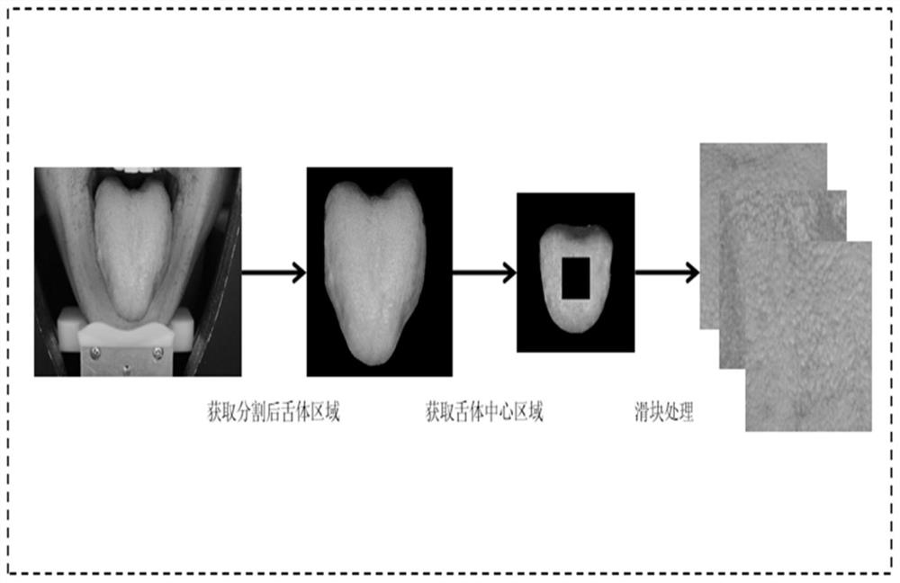 Traditional Chinese medicine tongue picture greasiness classification method containing noisy annotation data