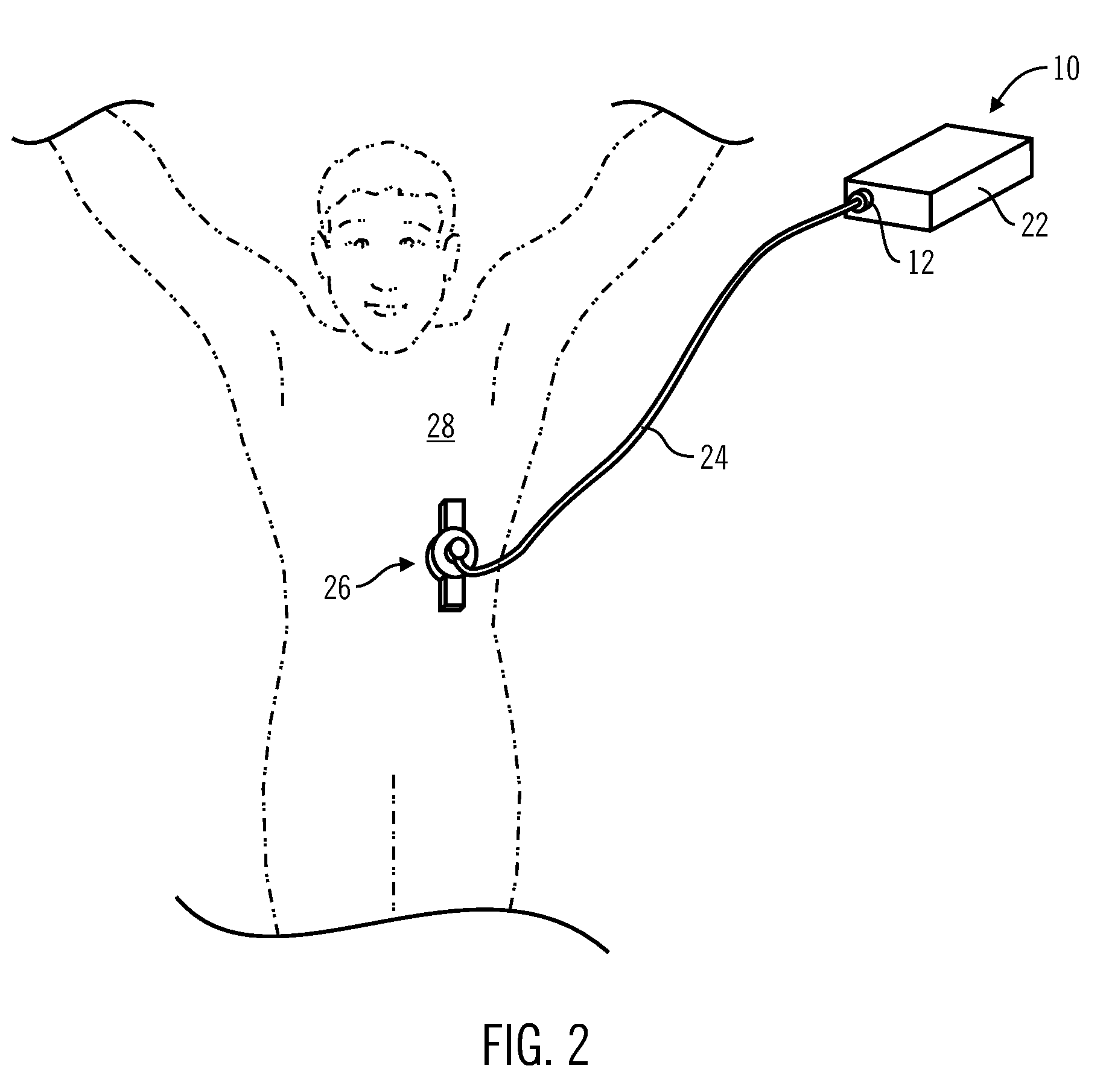 Control Tabs for Infusion Devices and Methods of Using the Same