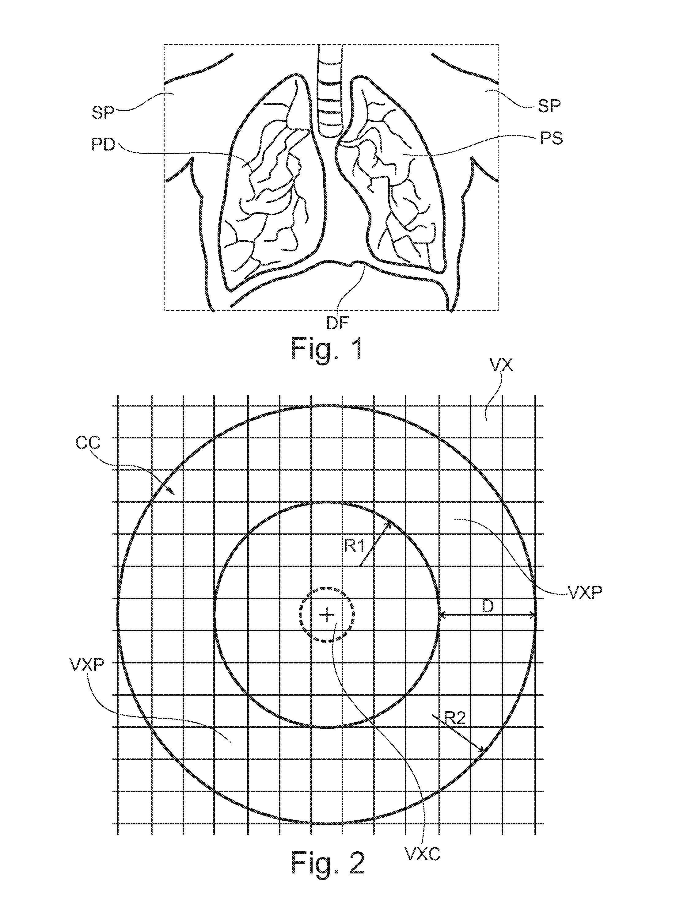 Method for determining inhomogeneity in animal tissue and equipment to implement it