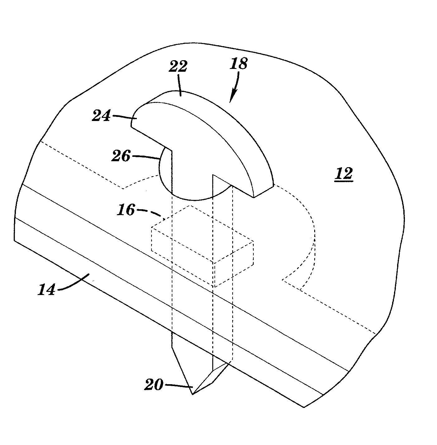Method and apparatus for retaining an ornament