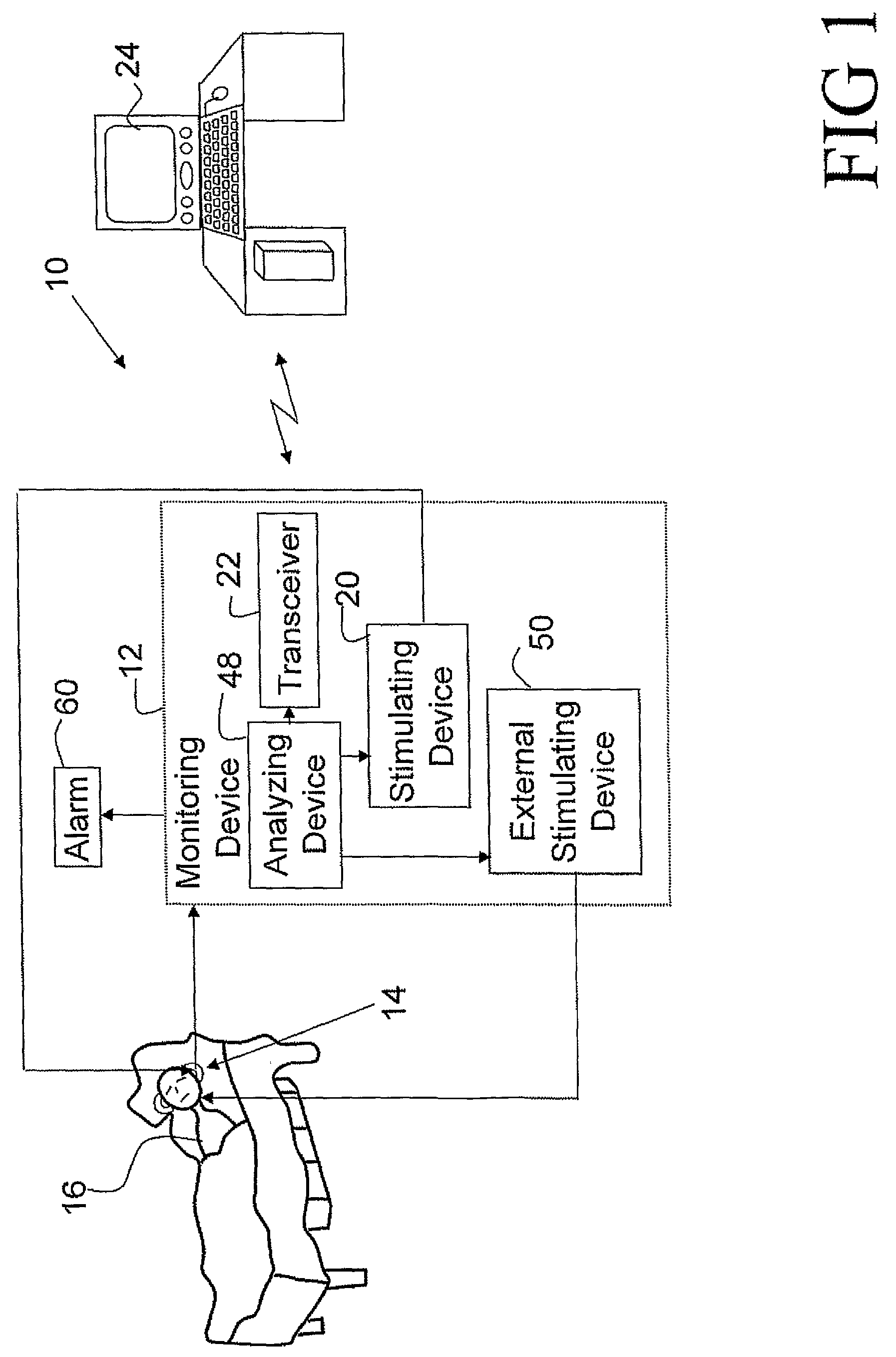 External device that continuously monitors for OSDB and delivers audio stimulation therapy