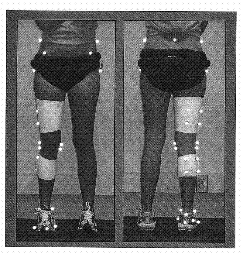 Method for auxiliary evaluation of stress states of knee joints