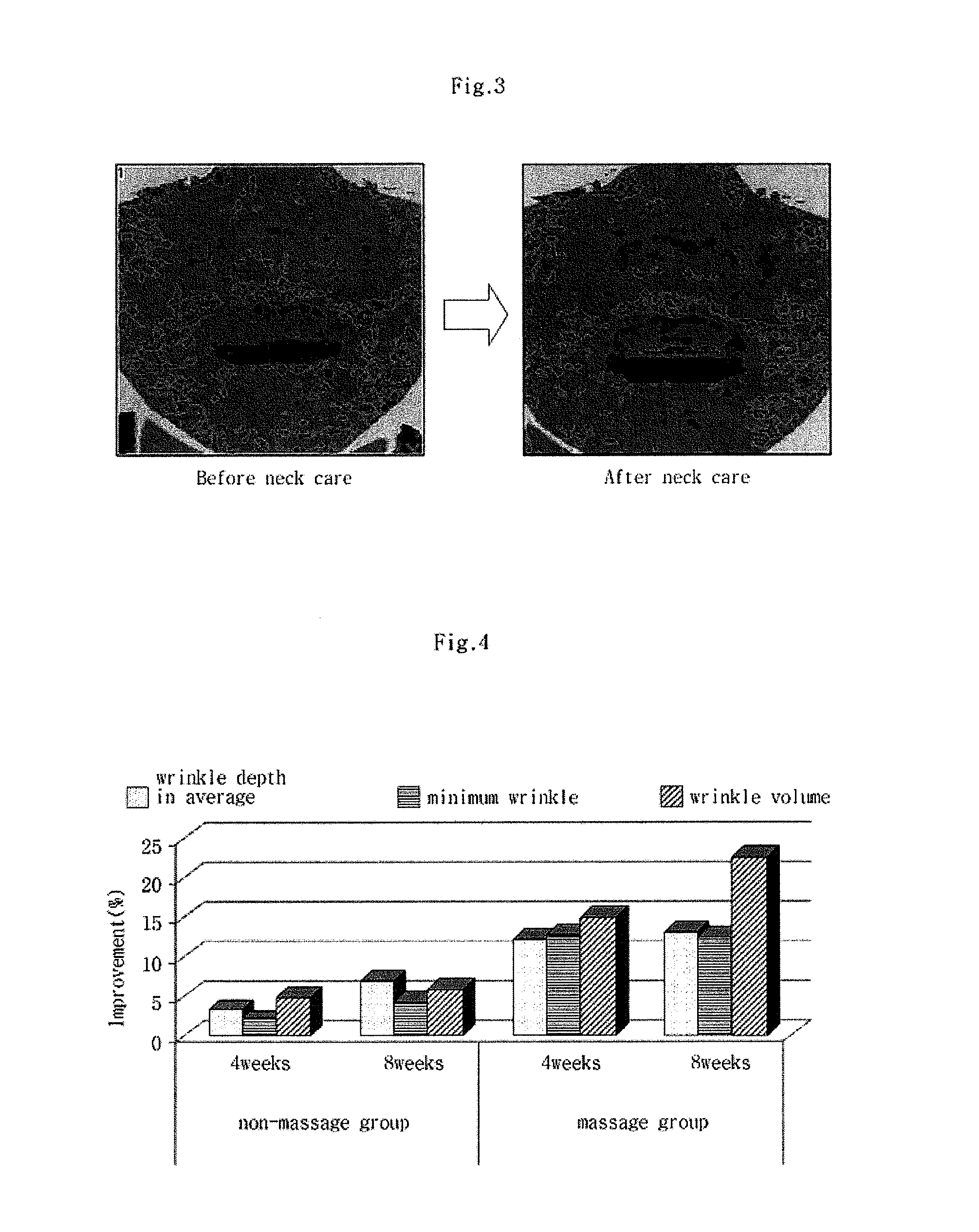 Method for neck care, and neck care kit comprising the method