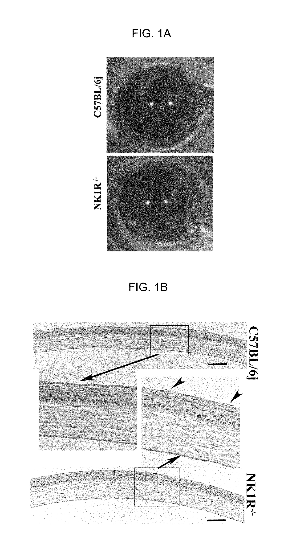 Neurokinin 1 receptor agonist mediated protection of the eye