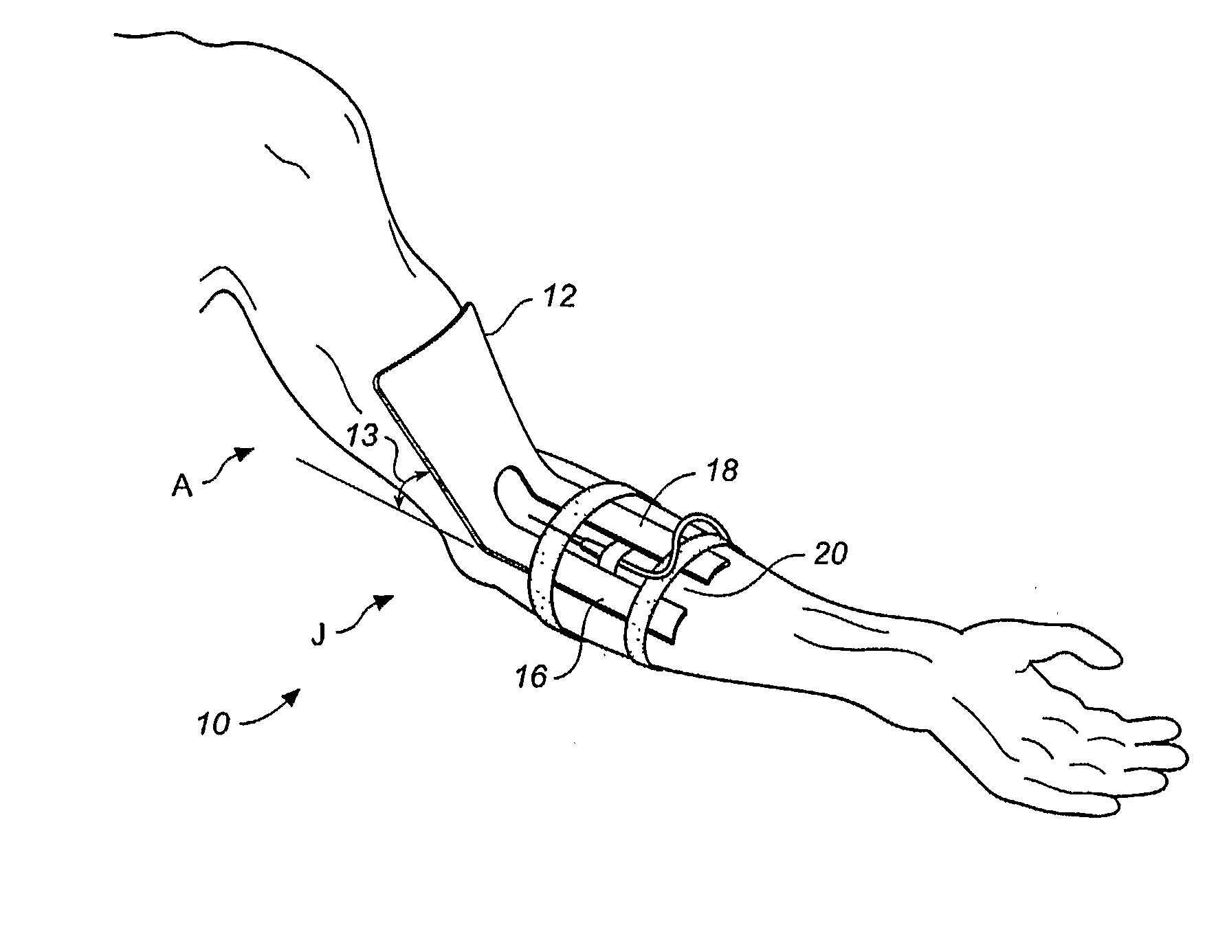 IV Compatible limb stabilization apparatus