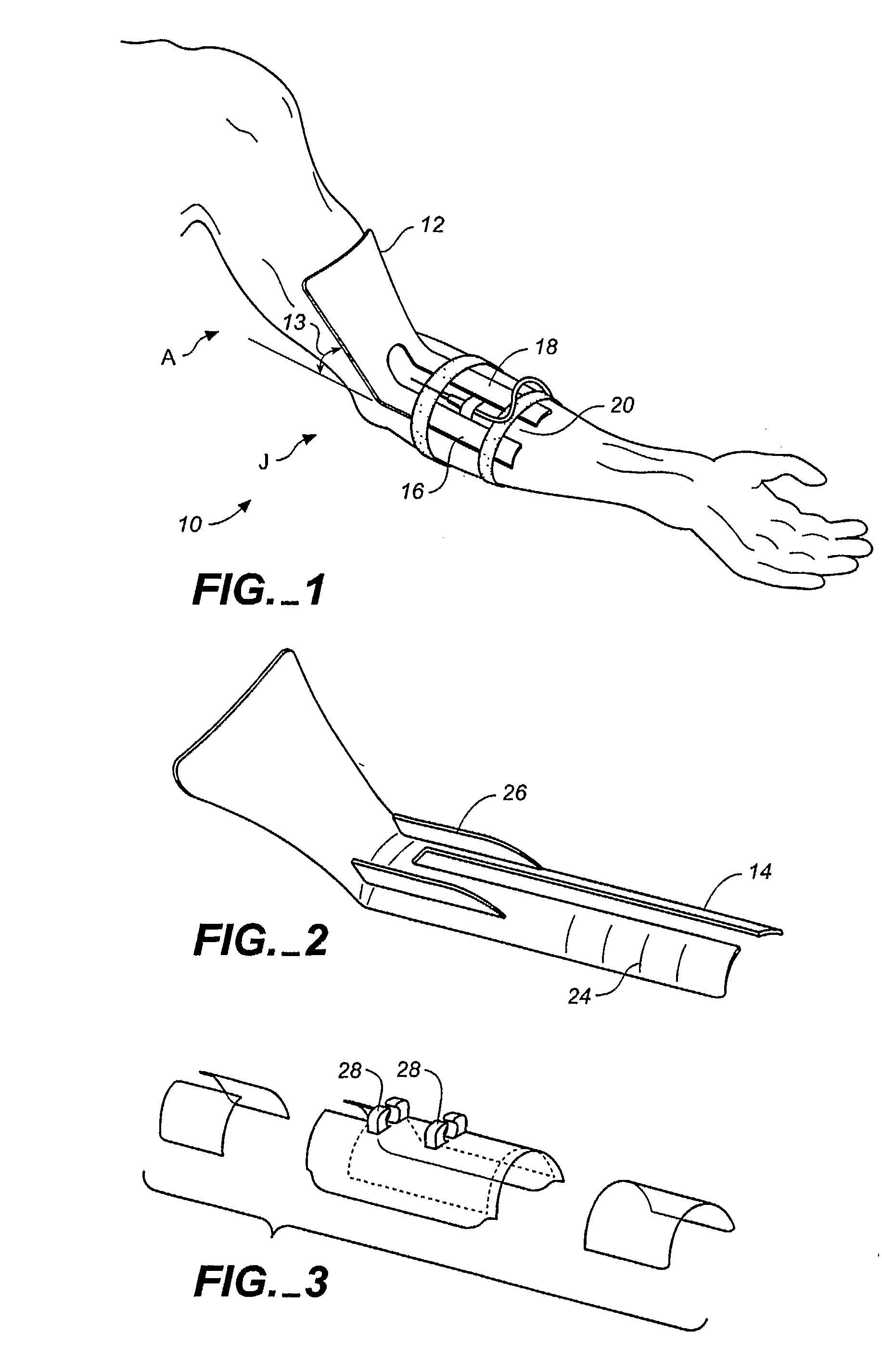 IV Compatible limb stabilization apparatus
