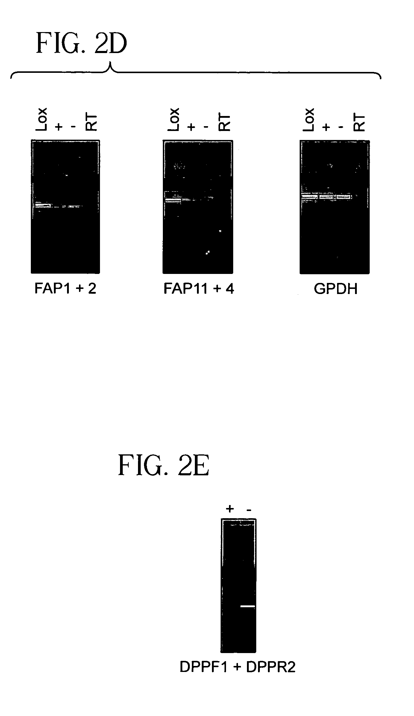 Compositions and methods for inhibition of cancer invasion and angiogenesis
