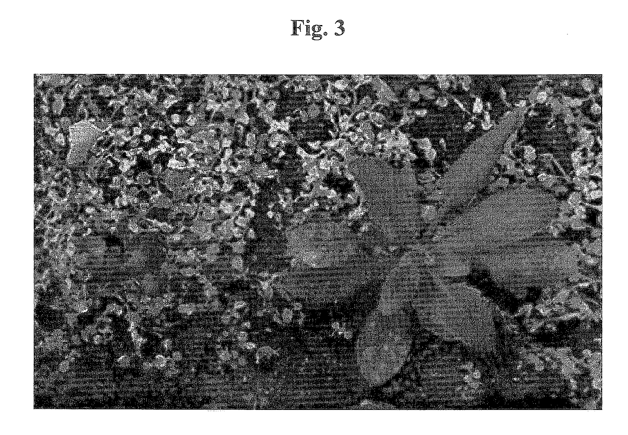 Polypeptide having Methionine Synthesis Function, Polynucleotide Encoding the Polypeptide, and Those Use