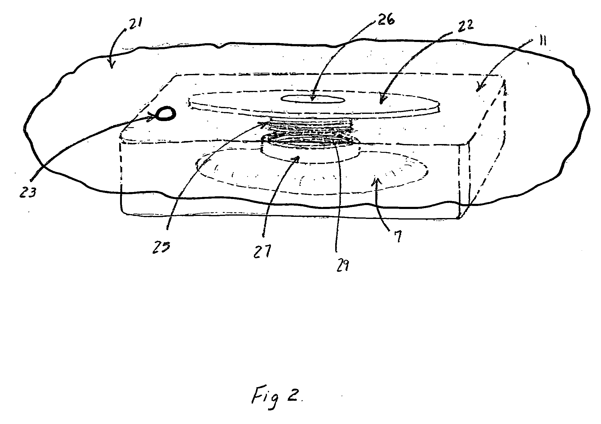 Fluid isolation device and method for treatment of fistulas