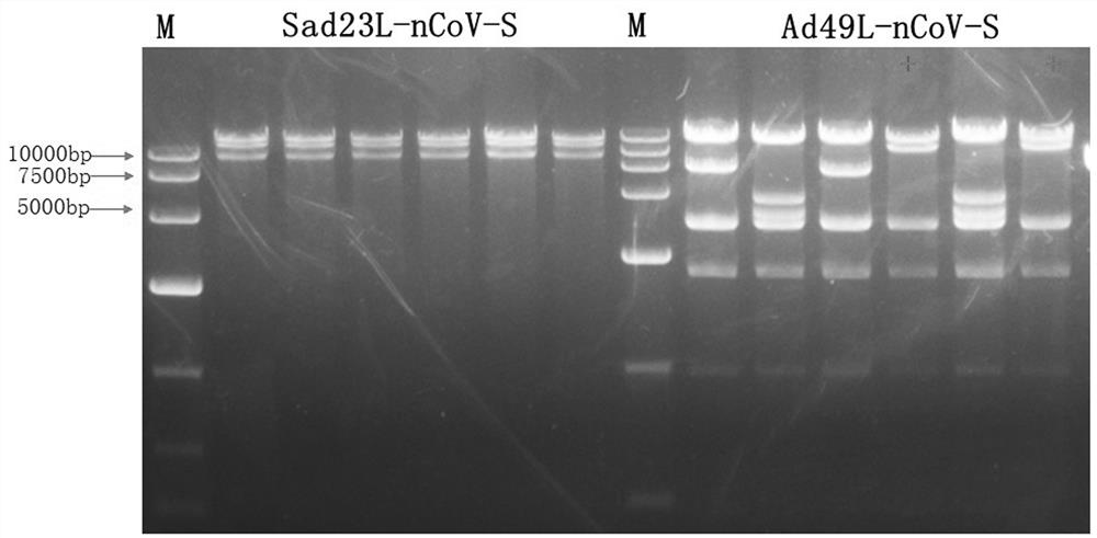 Novel coronavirus pneumonia vaccine based on novel adenovirus vector sad23l and/or ad49l