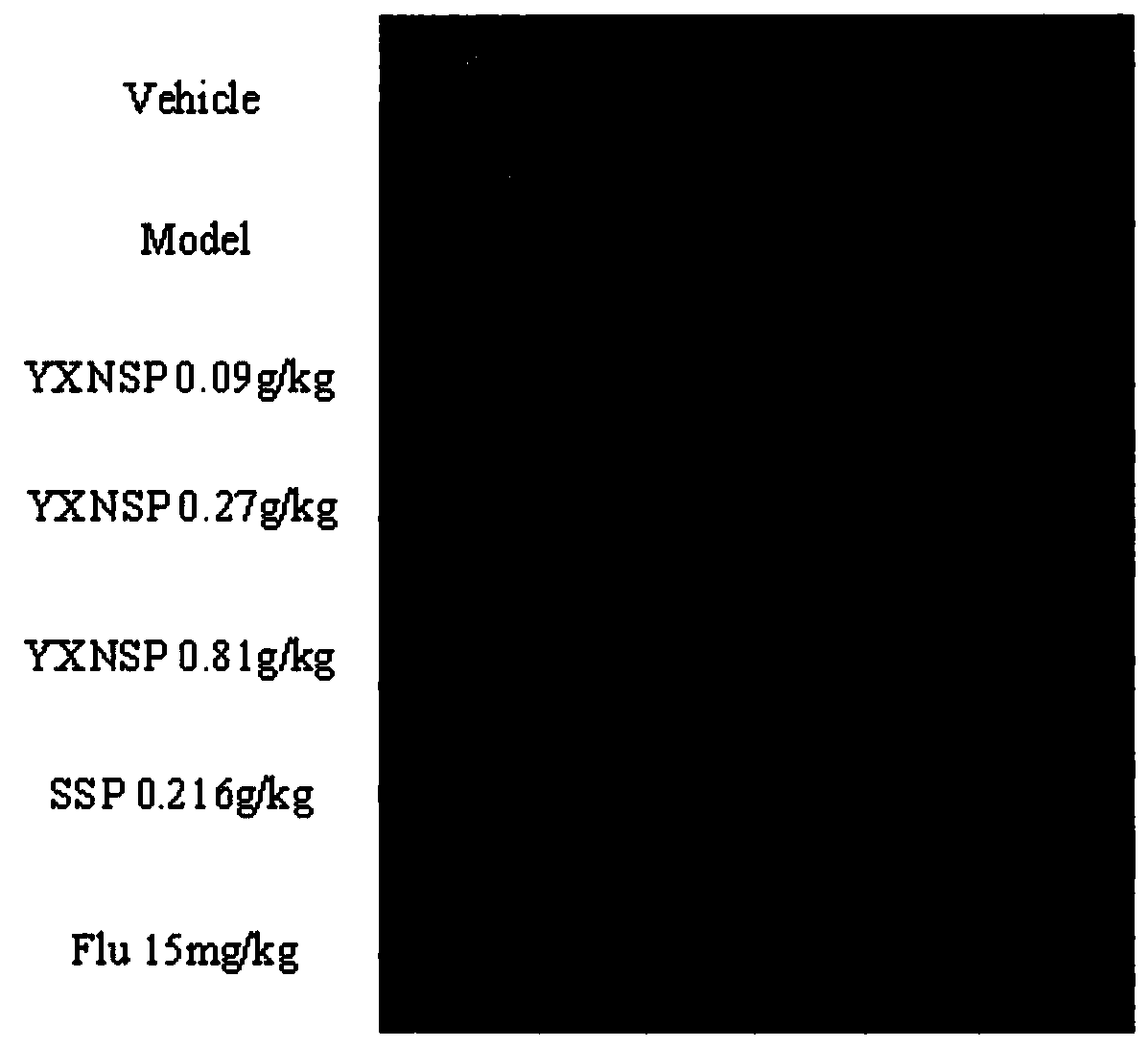 Application of Yixin Ningshen Tablets in the Preparation of Drugs for Treating Heart Diseases