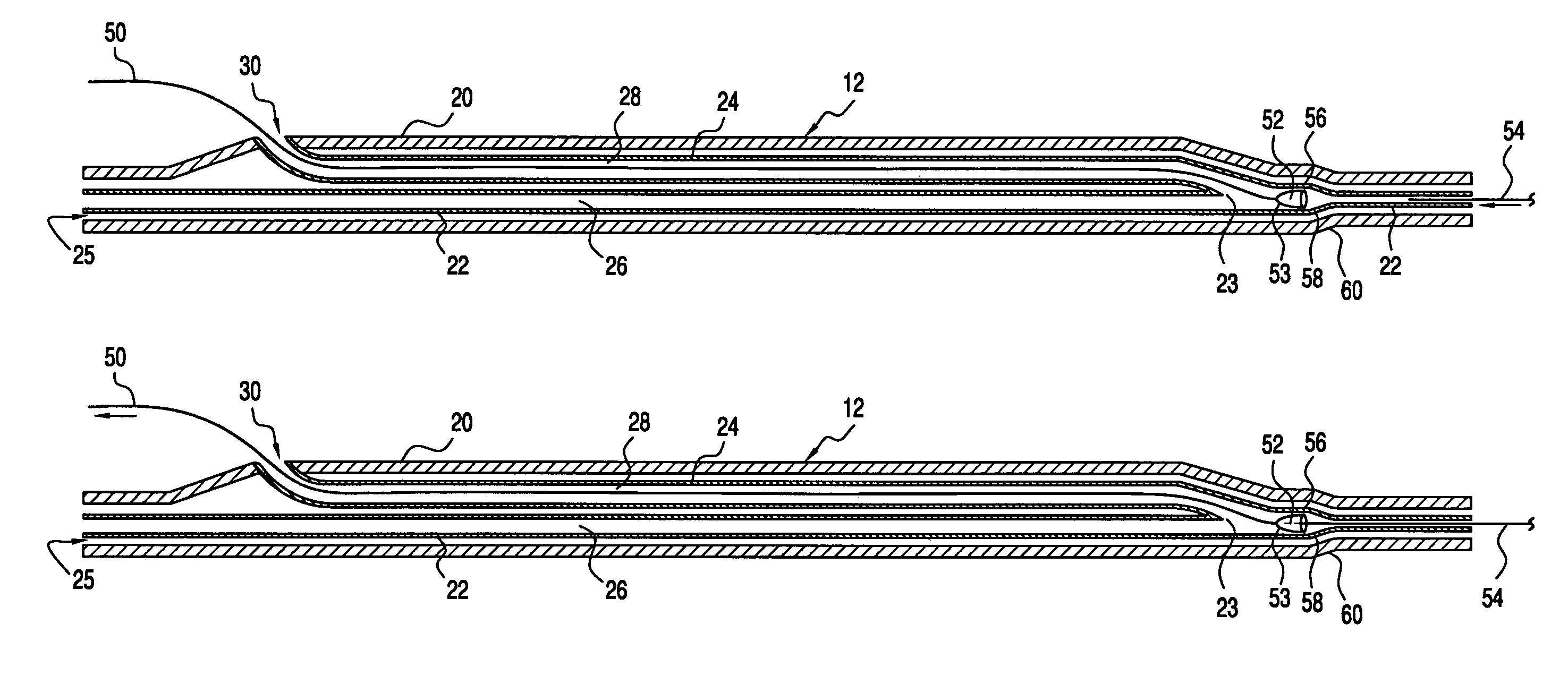 Catheter having an auxiliary lumen for use with a functional measurement wire