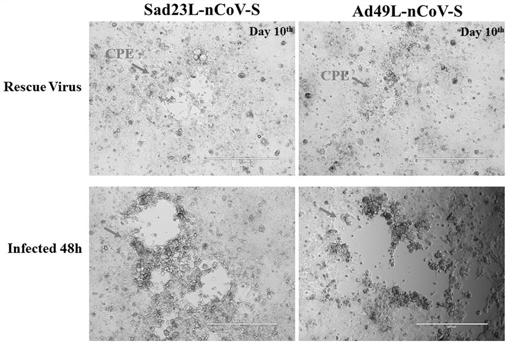 Severe acute respiratory syndrome coronavirus 2 vaccine based on novel adenovirus vectors Sad23L and/or Ad49L