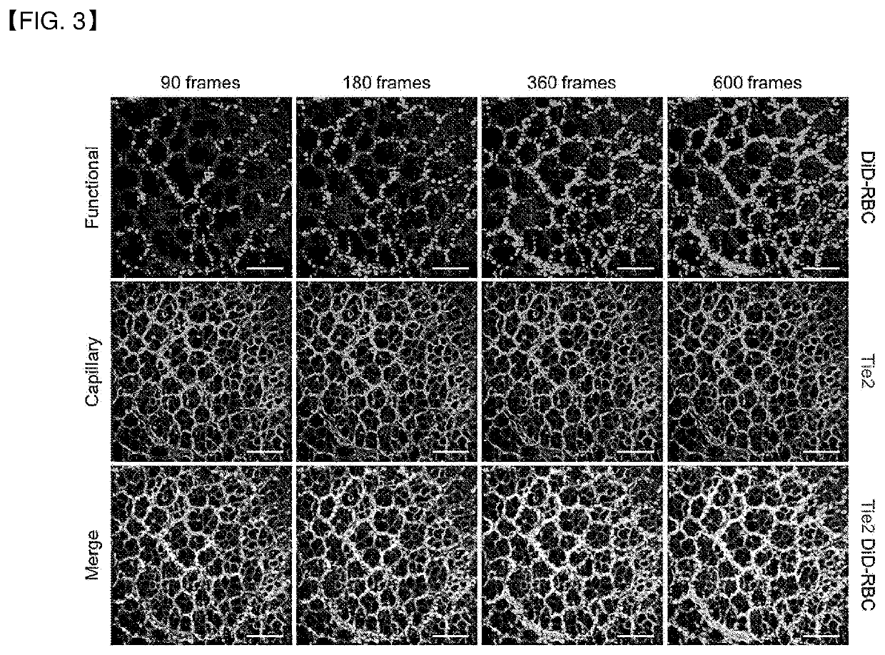 Method and apparatus for quantitation of microcirculation