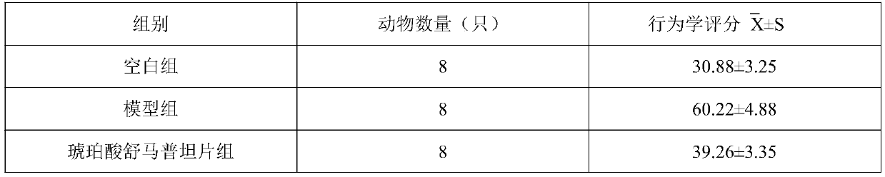 Application and composition of human urinary kallidinogenase in preparing medicine for treating migraine