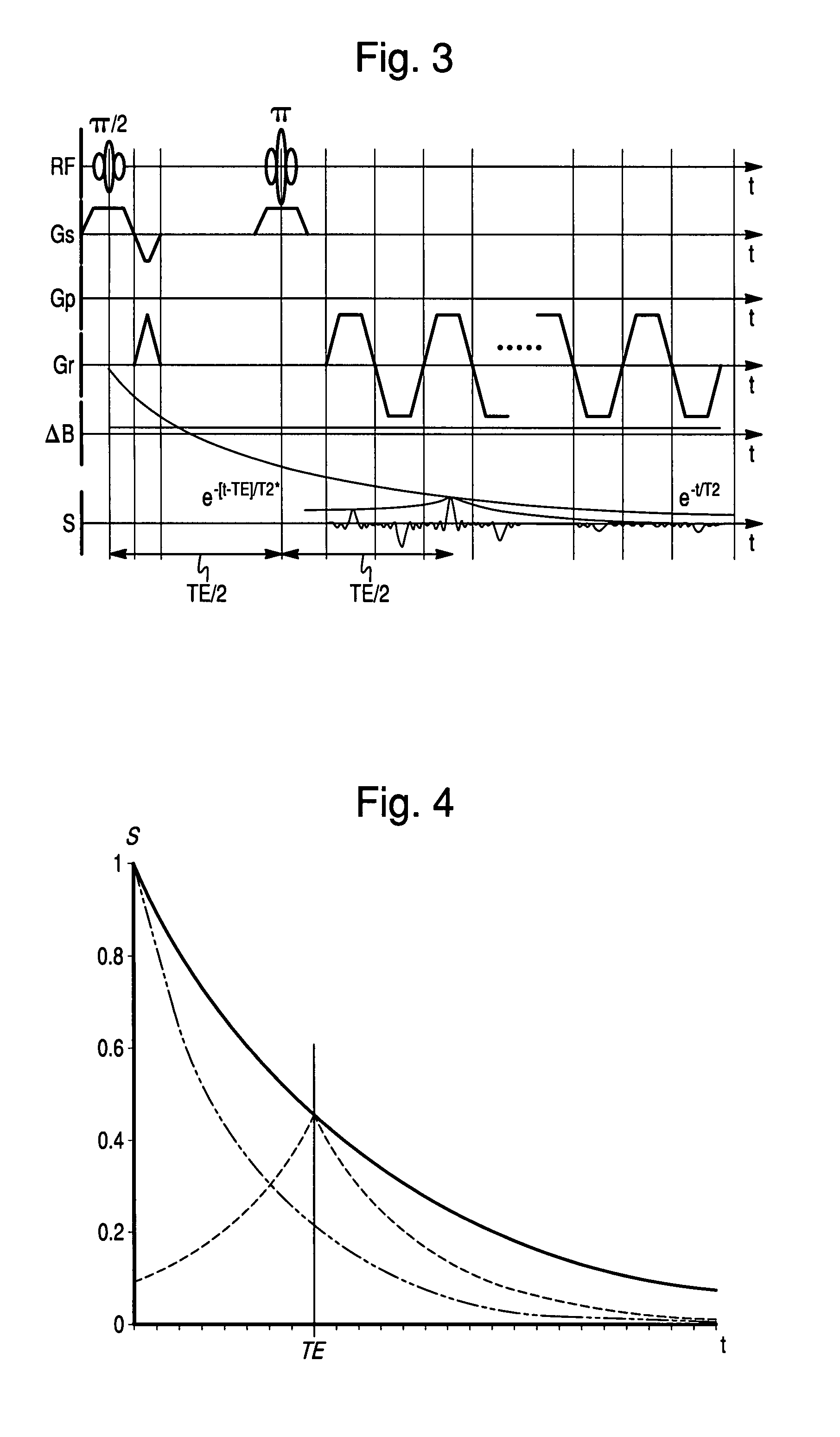 Method of obtaining a magnetic resonance image in which the streak artifacts are corrected using non-linear phase correction