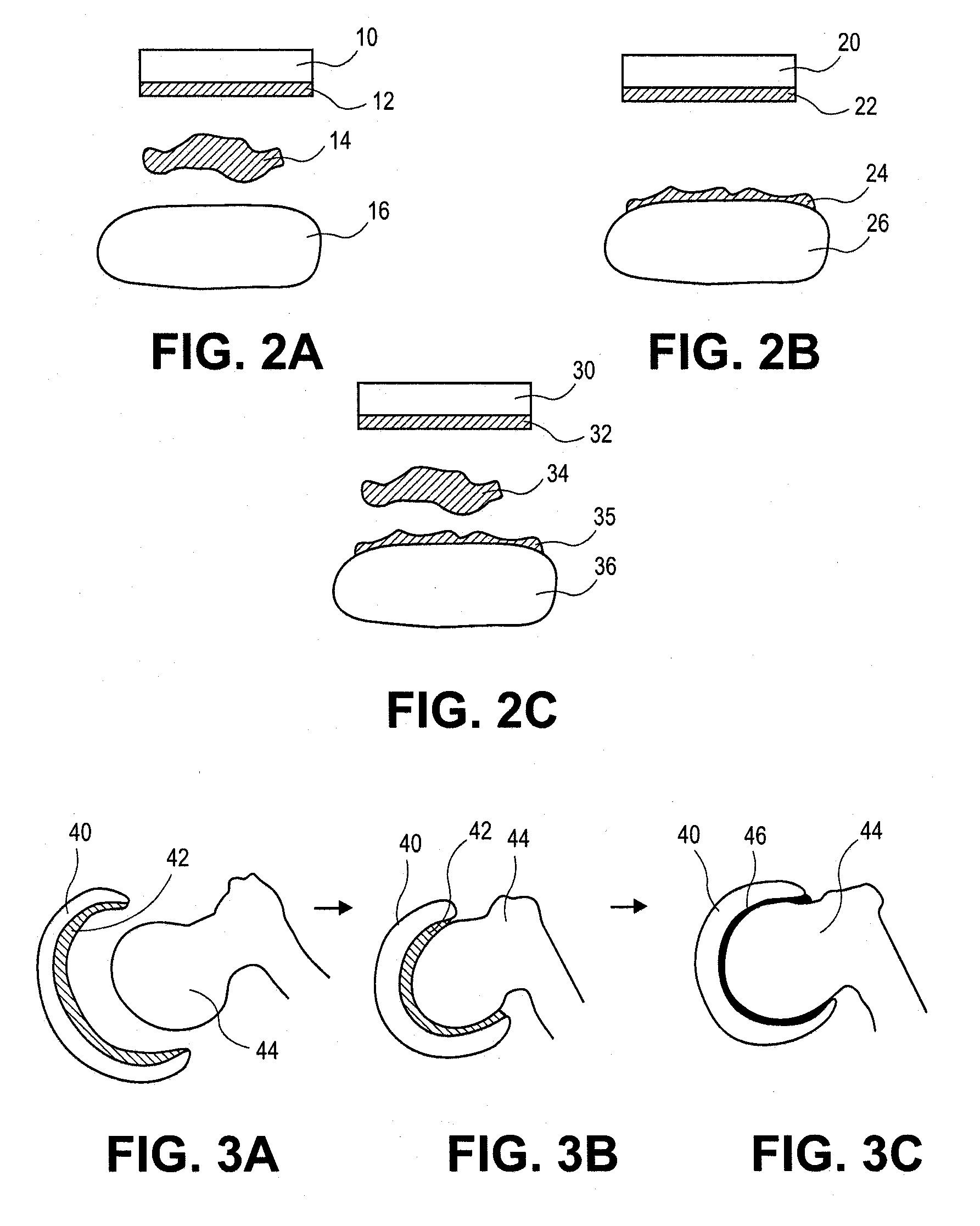 Methods, Devices and Compositions for Adhering Hydrated Polymer Implants to Bone