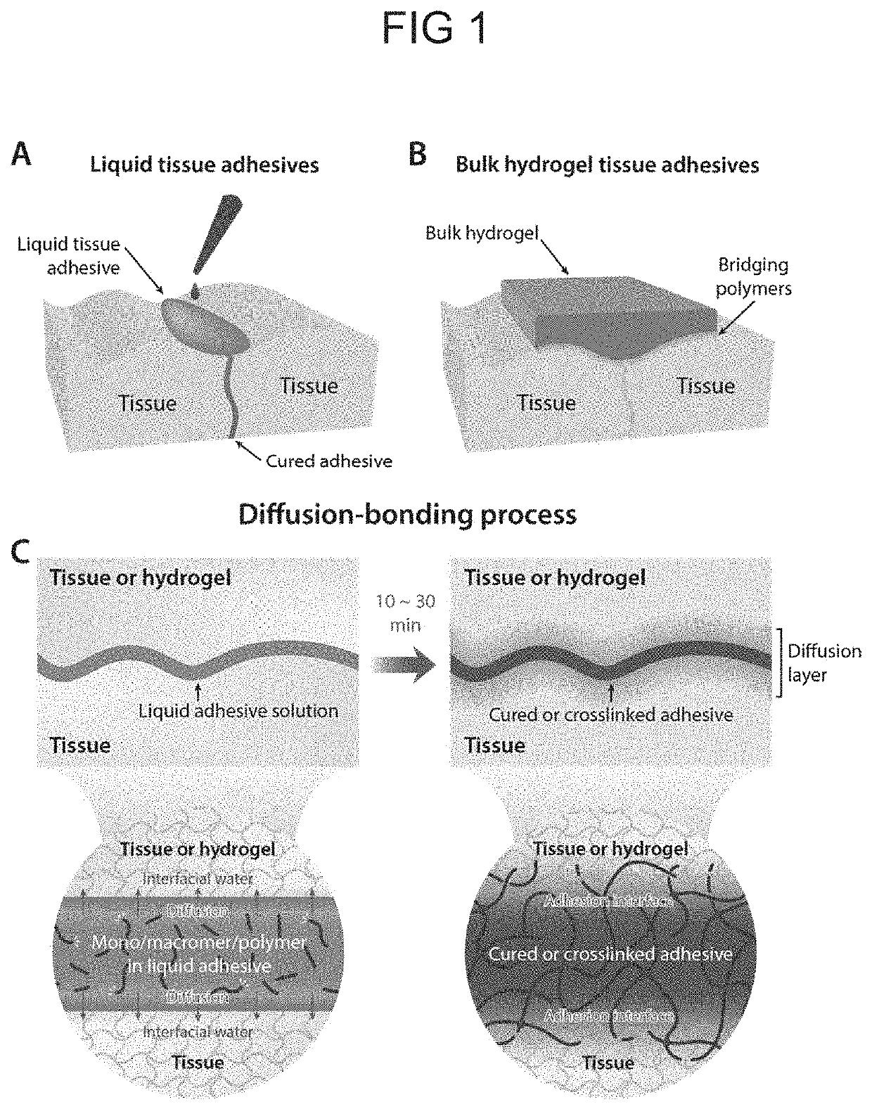 Adhesive material with triggerable on-demand detachment