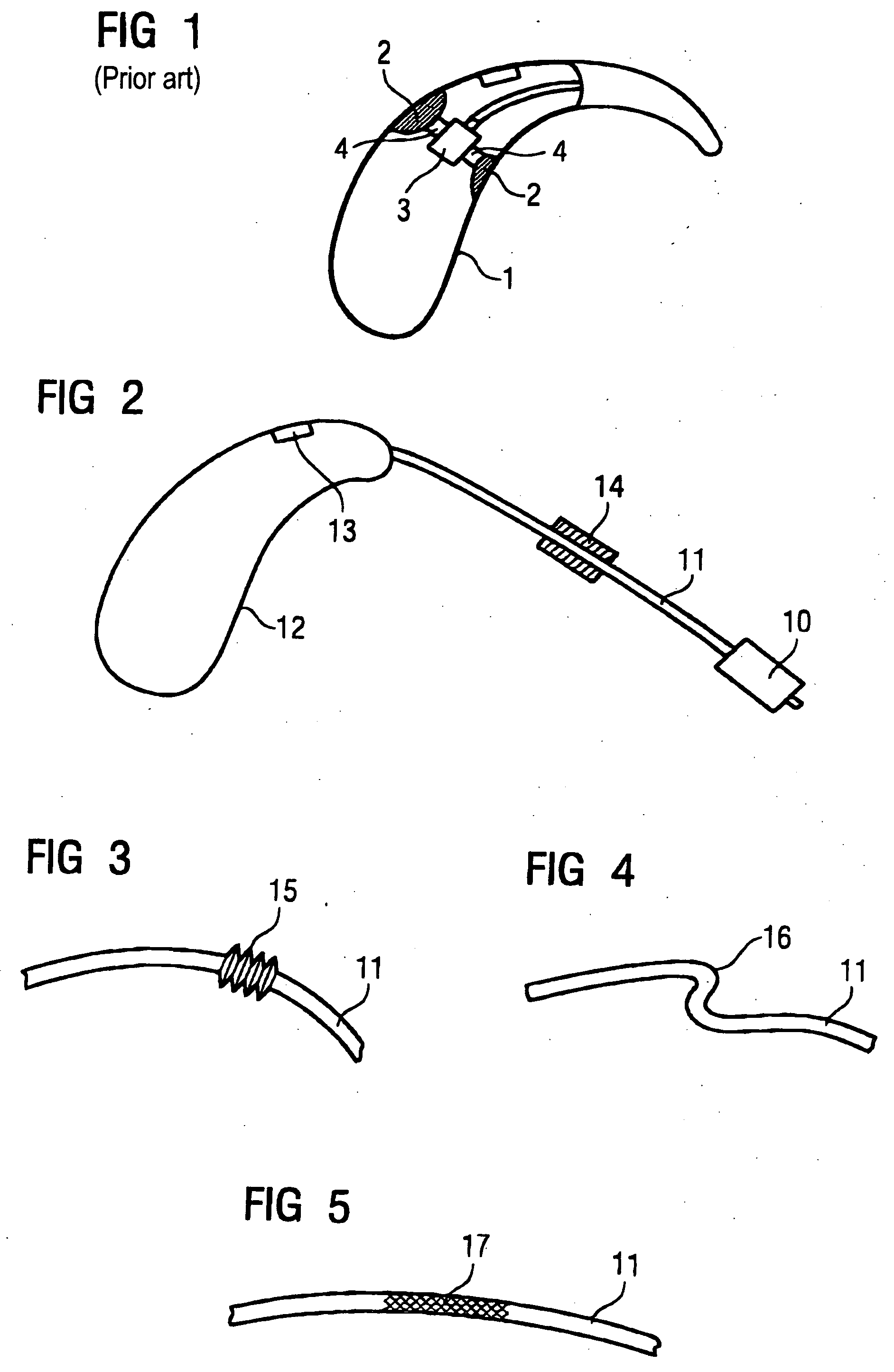 Hearing device with a damping element