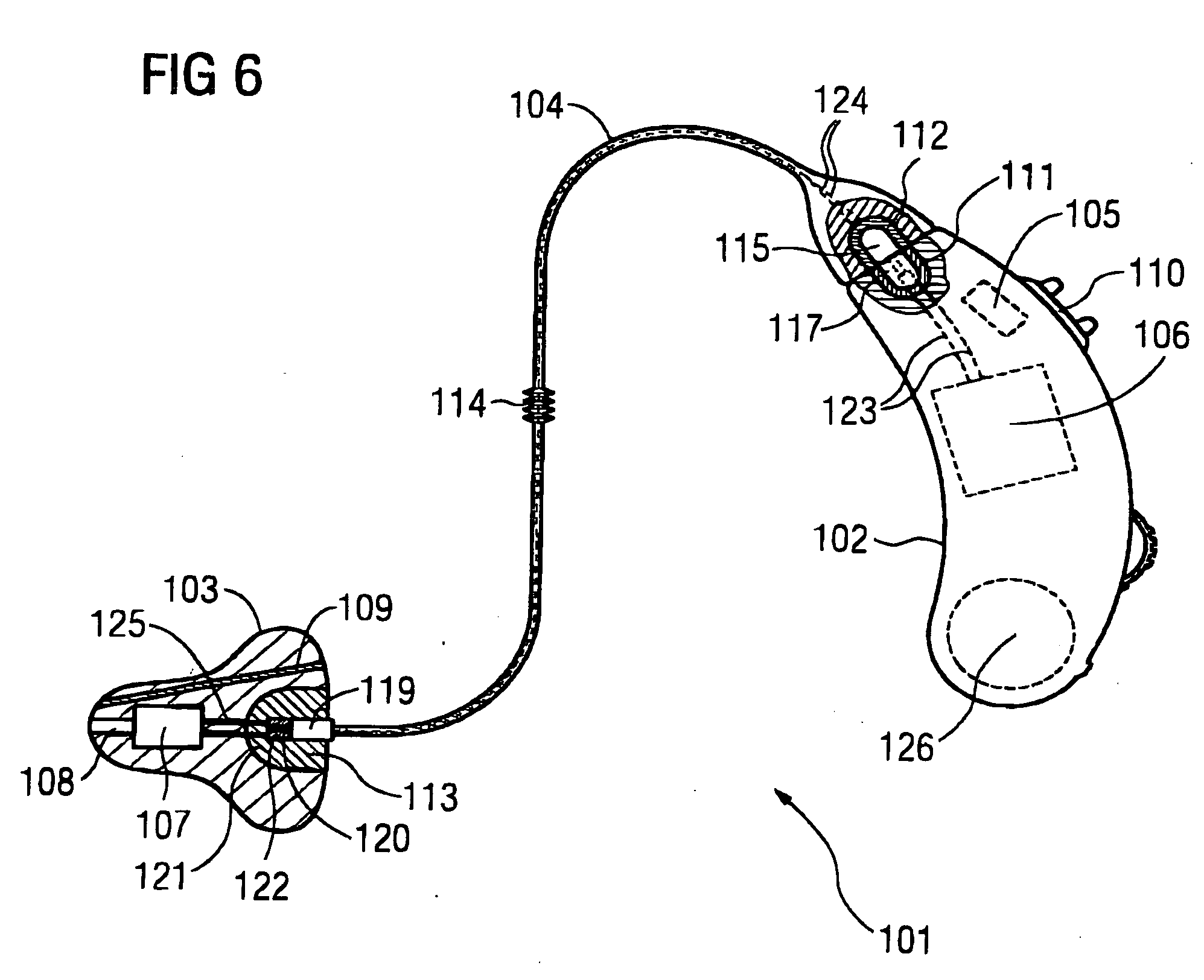 Hearing device with a damping element