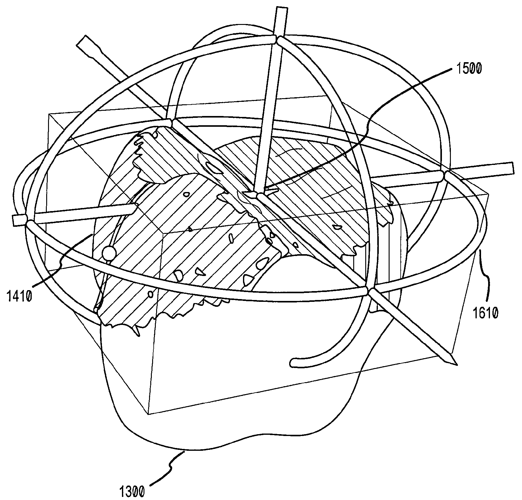 System and method for automatic construction of tooth axes