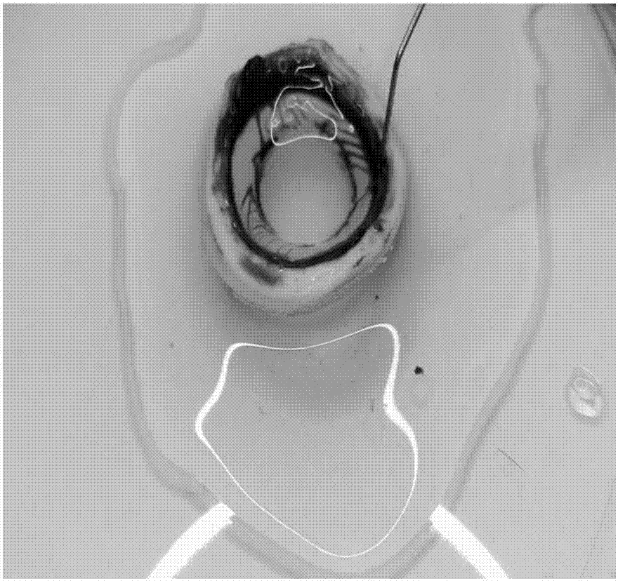 A kind of graft sheet for Descemet's membrane endothelial transplantation and its vacuole separation and preparation method