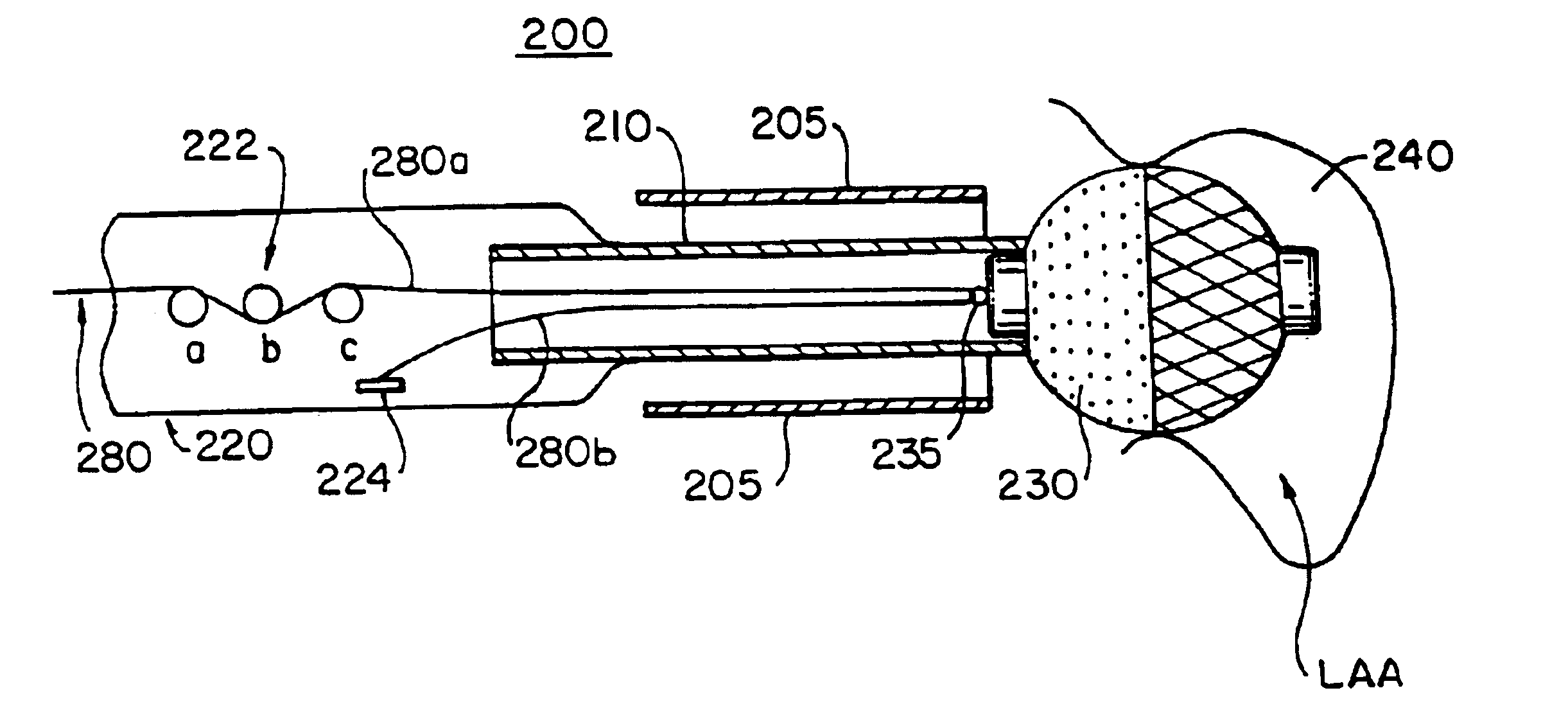 Cardiac implant device tether system and method