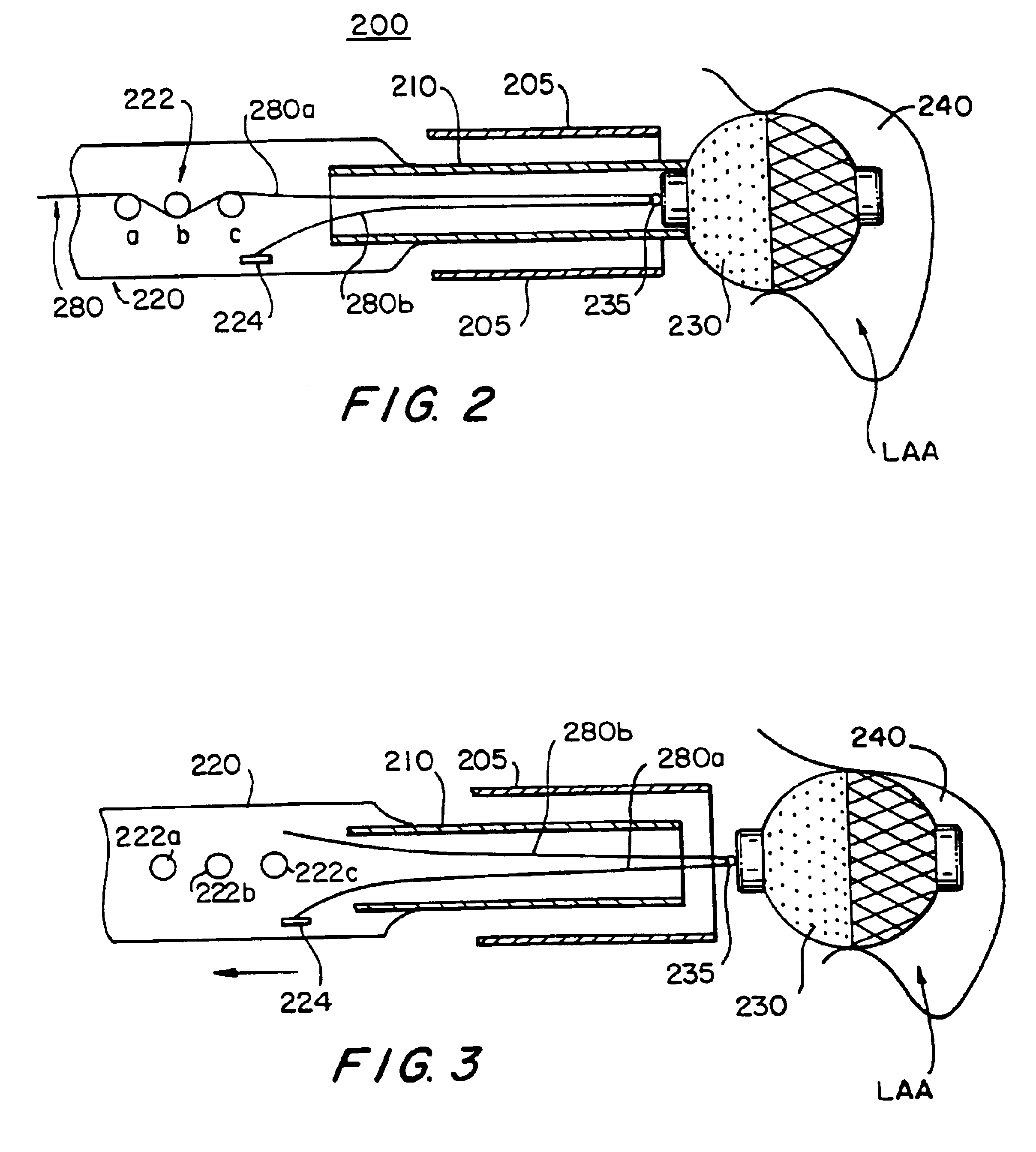 Cardiac implant device tether system and method