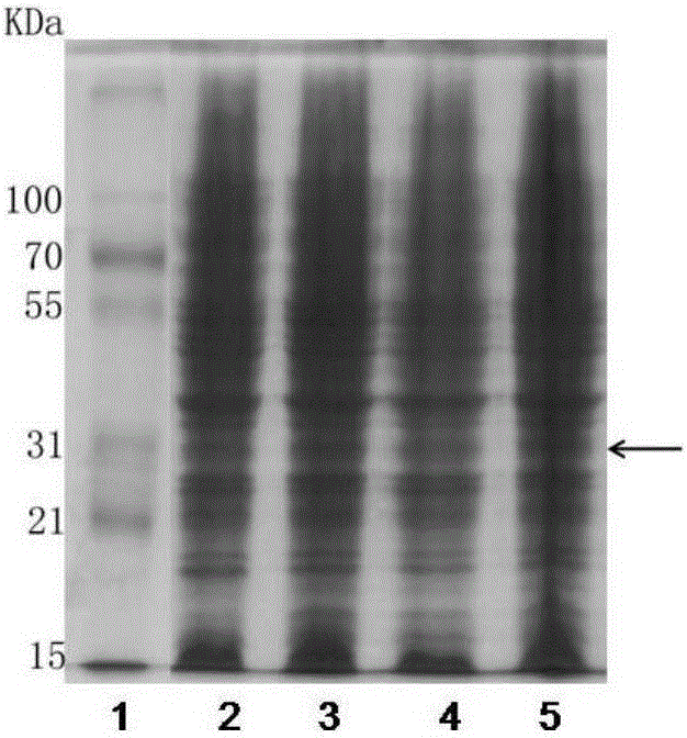 Anti-human C-reactive protein antibody and application thereof