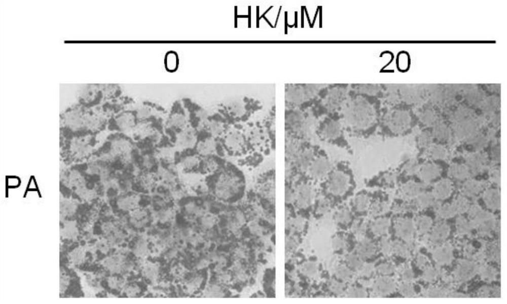 Application of Hyperforcinol K in preparation of medicine for preventing and treating non-alcoholic fatty liver disease