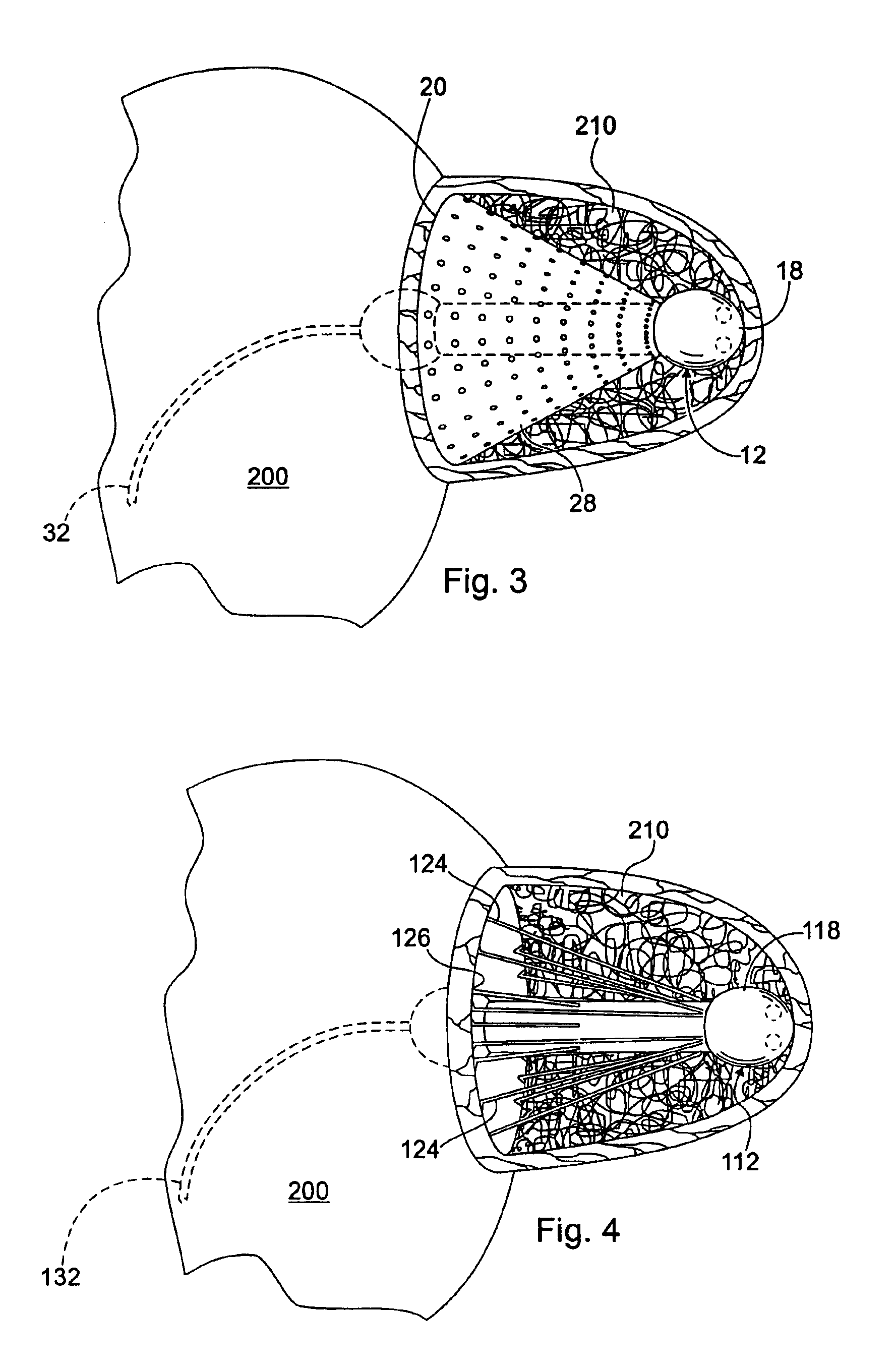 Cardiac stimulating apparatus having a blood clot filter and atrial pacer