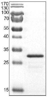 Preparation method, epitope identification and application of porcine CD163 protein monoclonal antibody