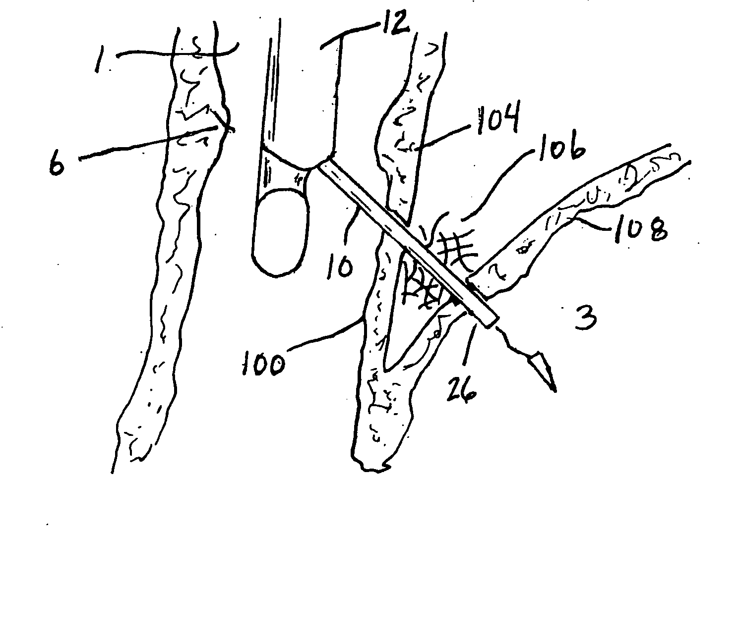 Methods and devices for anchoring to tissue