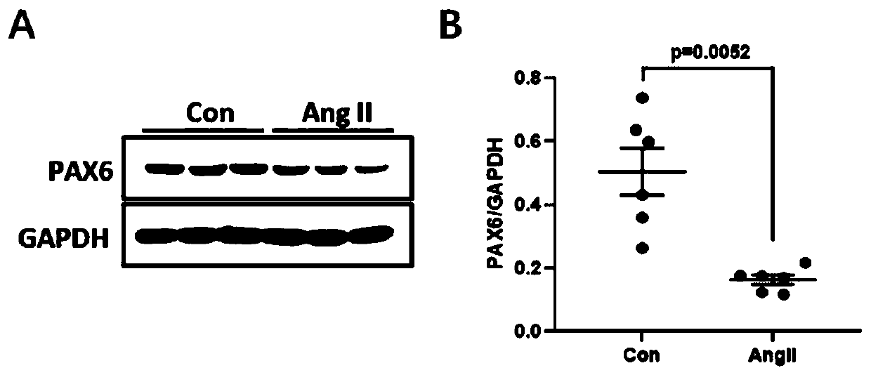 Application of PAX6 gene or expression product thereof to preparation of medicines for restraining fibrosis