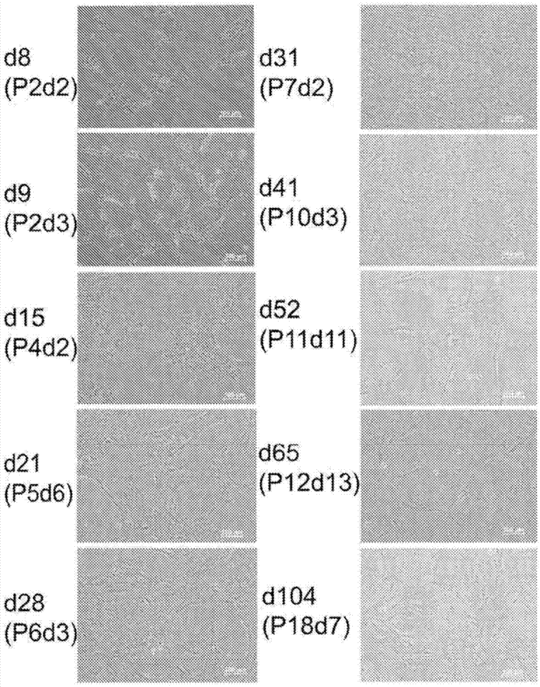 Compositions and methods for treating retinal diseases