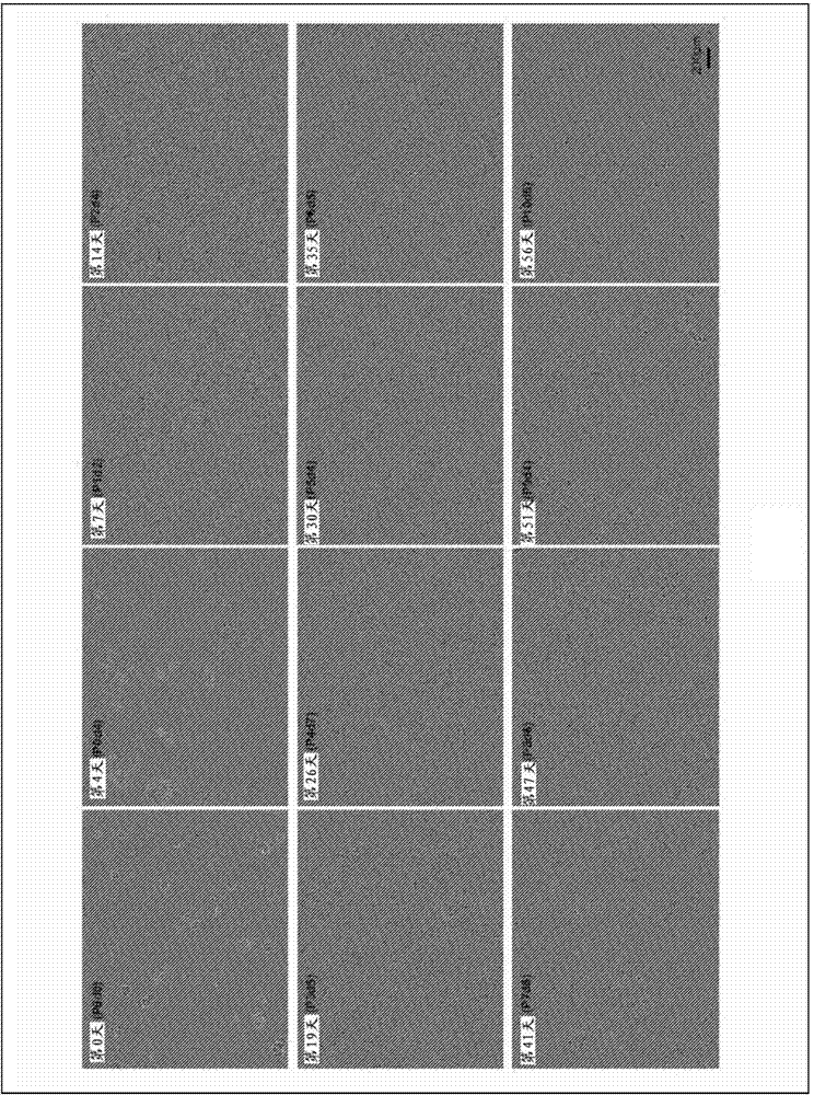 Compositions and methods for treating retinal diseases