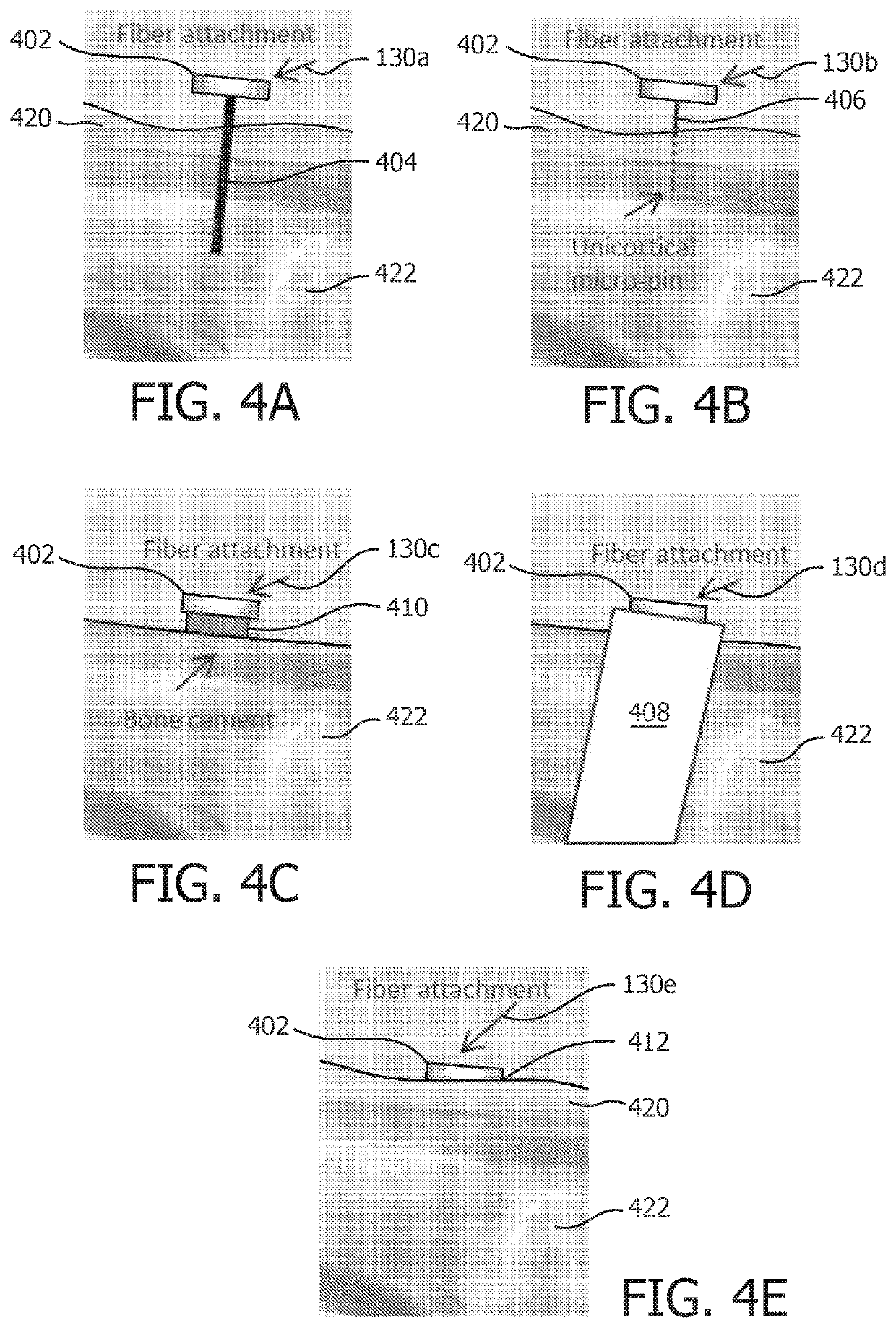 Shape sensing for orthopedic navigation