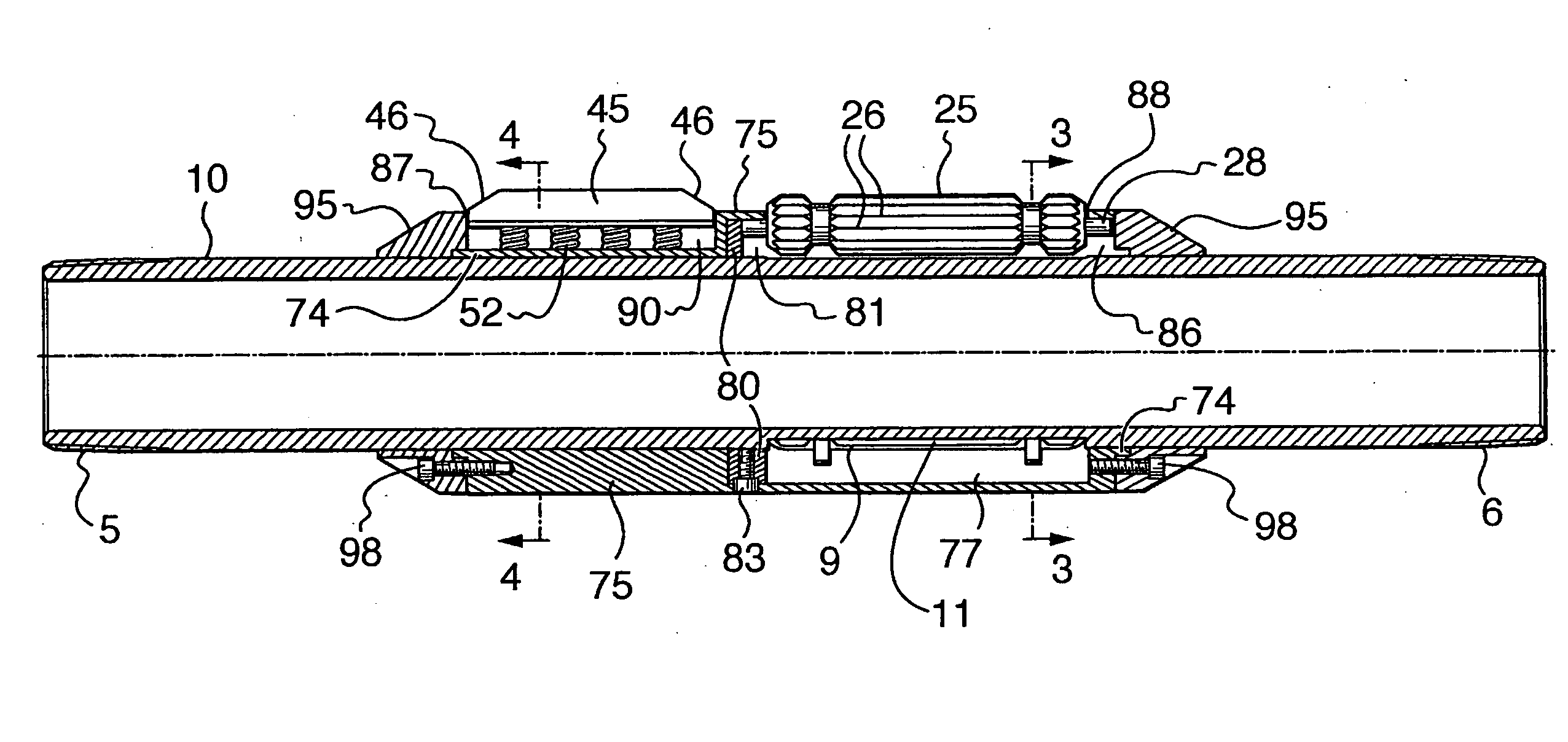 Torque anchor