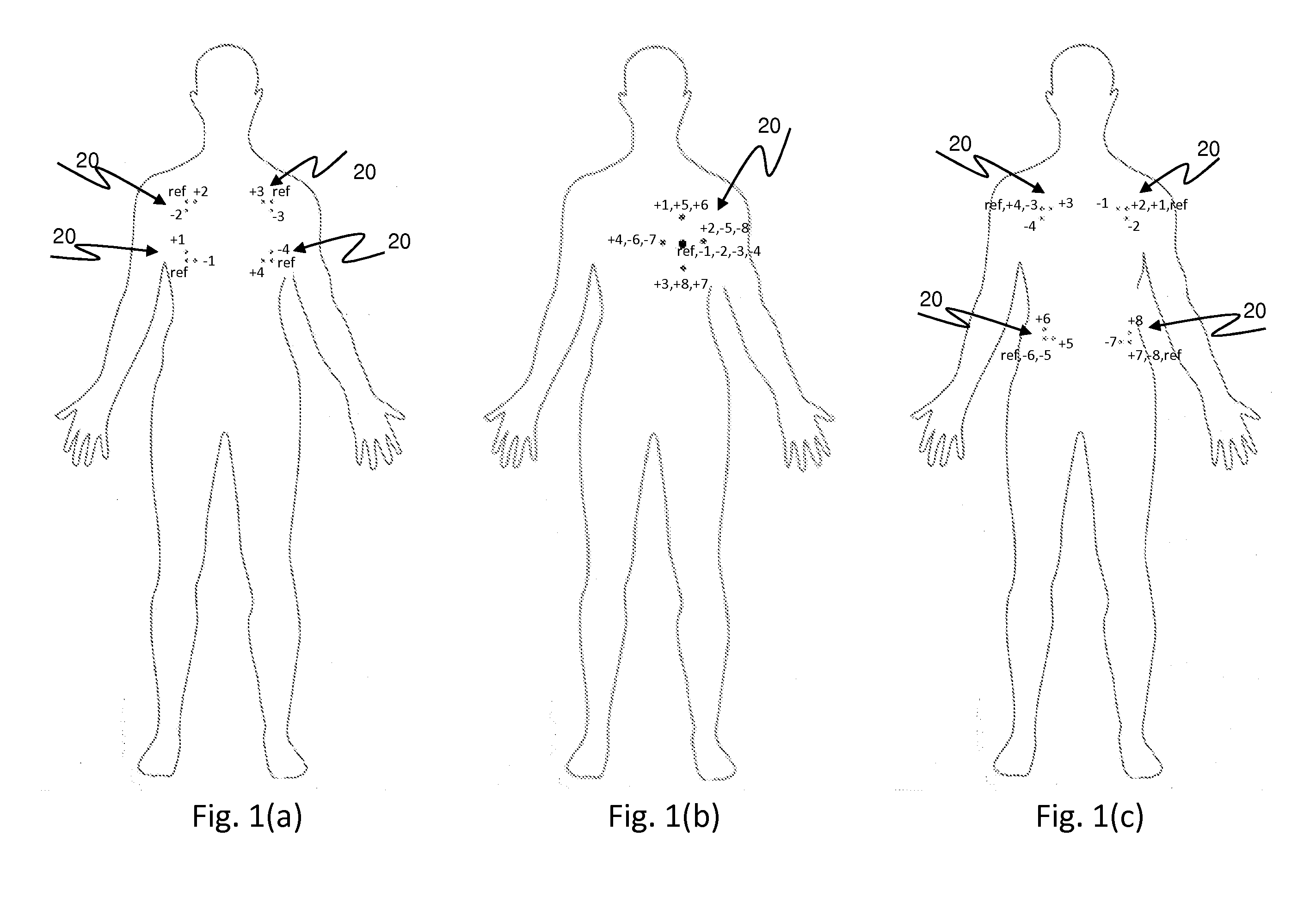 Leadless wireless ECG measurement system and method for measuring of bio-potential electrical activity of the heart