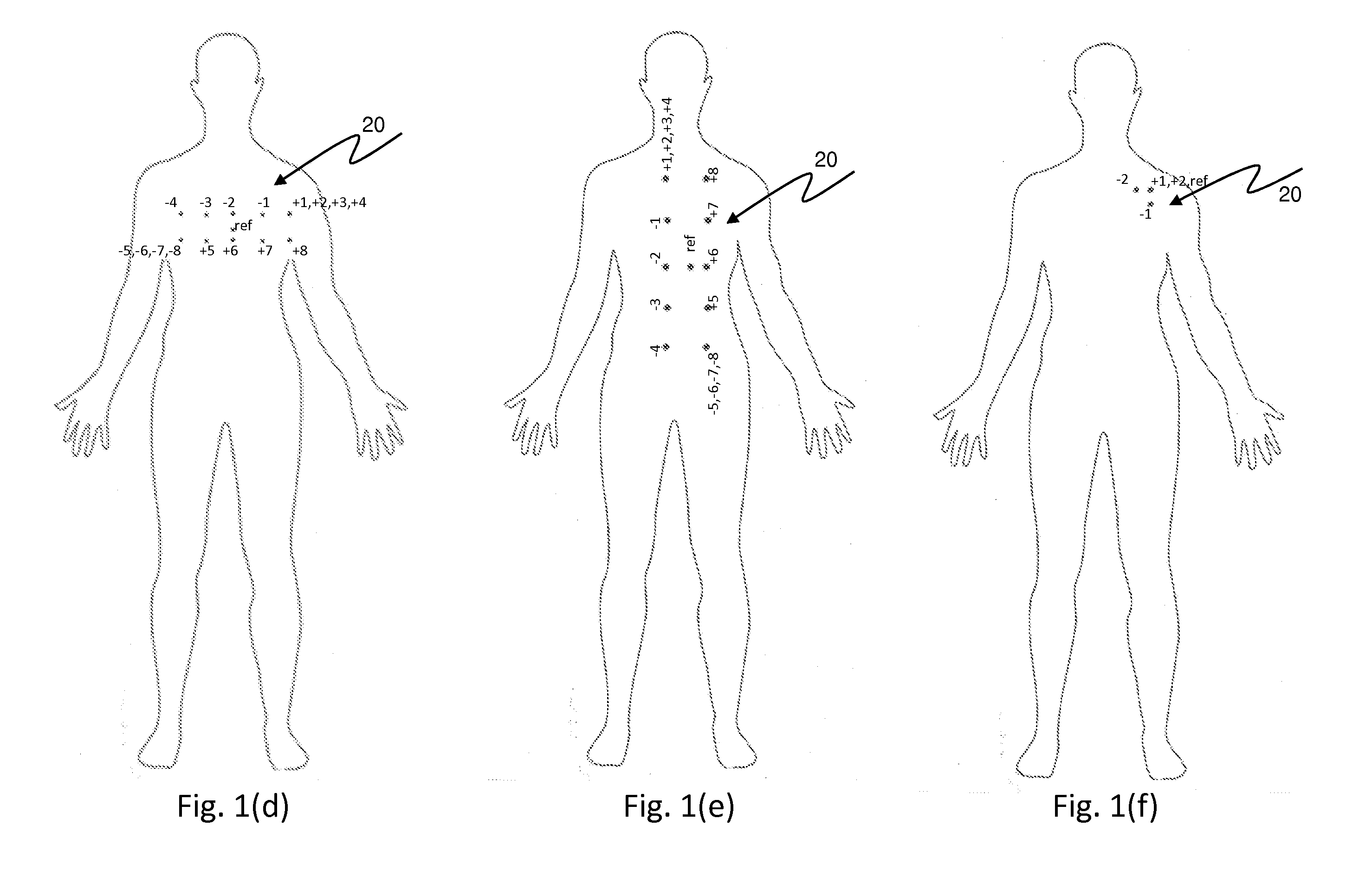 Leadless wireless ECG measurement system and method for measuring of bio-potential electrical activity of the heart