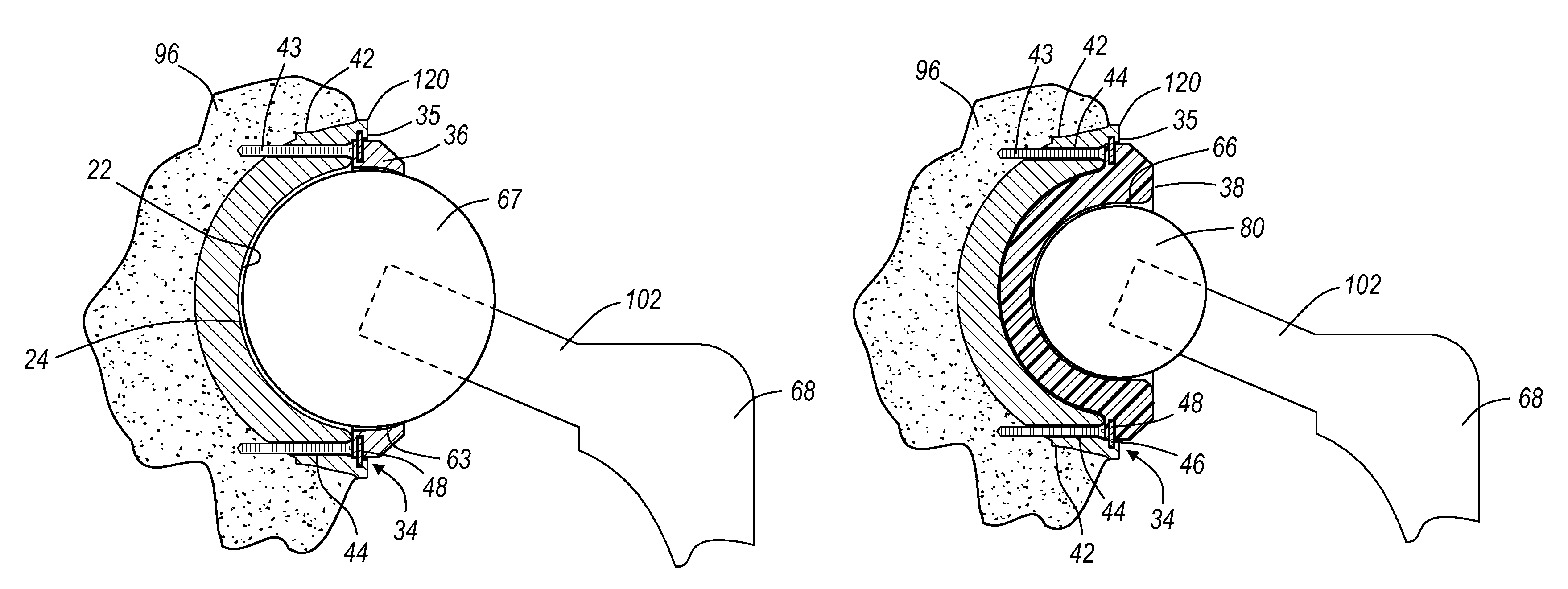 Method and apparatus for use of a metal-metal constrained liner