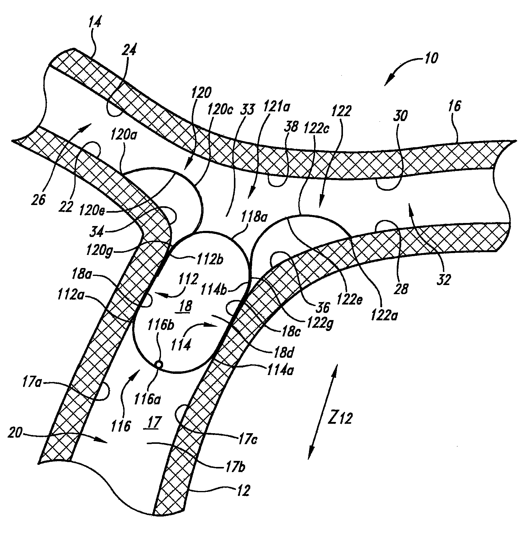 Vascular anchoring system and method