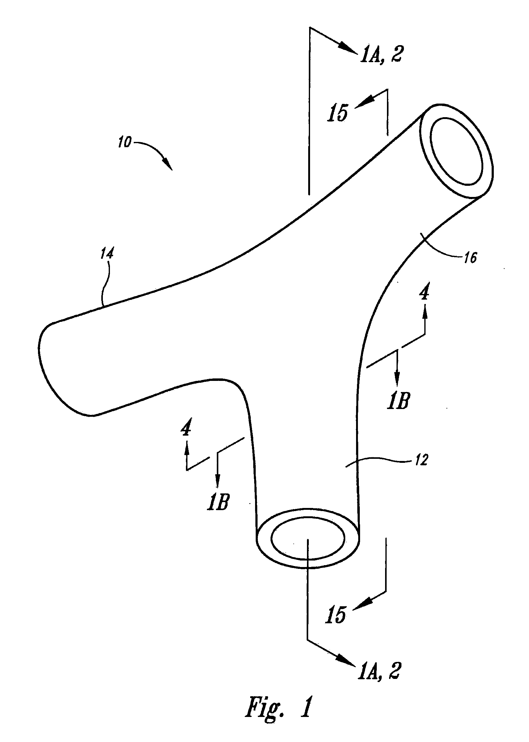 Vascular anchoring system and method