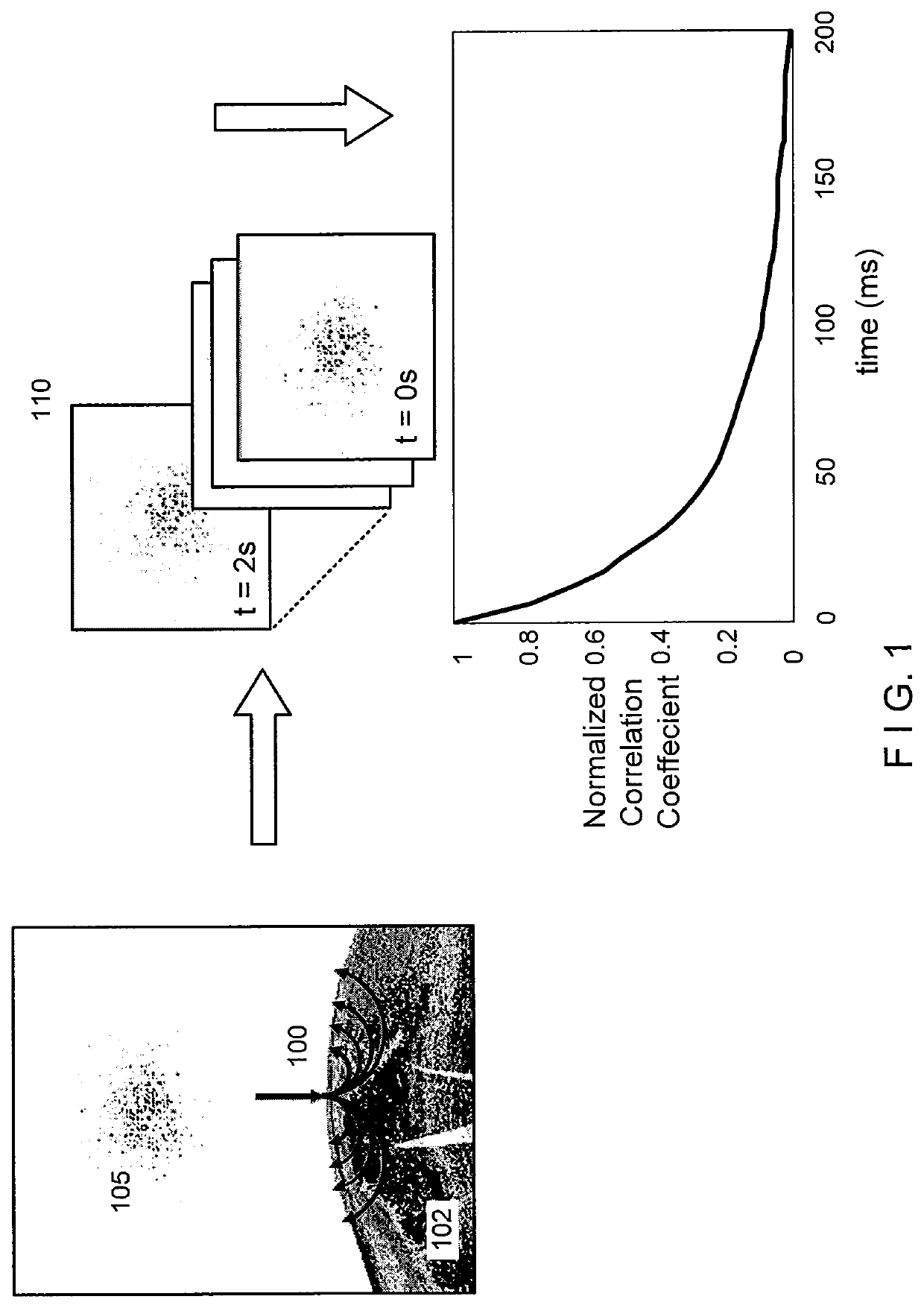 System and method providing intracoronary laser speckle imaging for the detection of vulnerable plaque