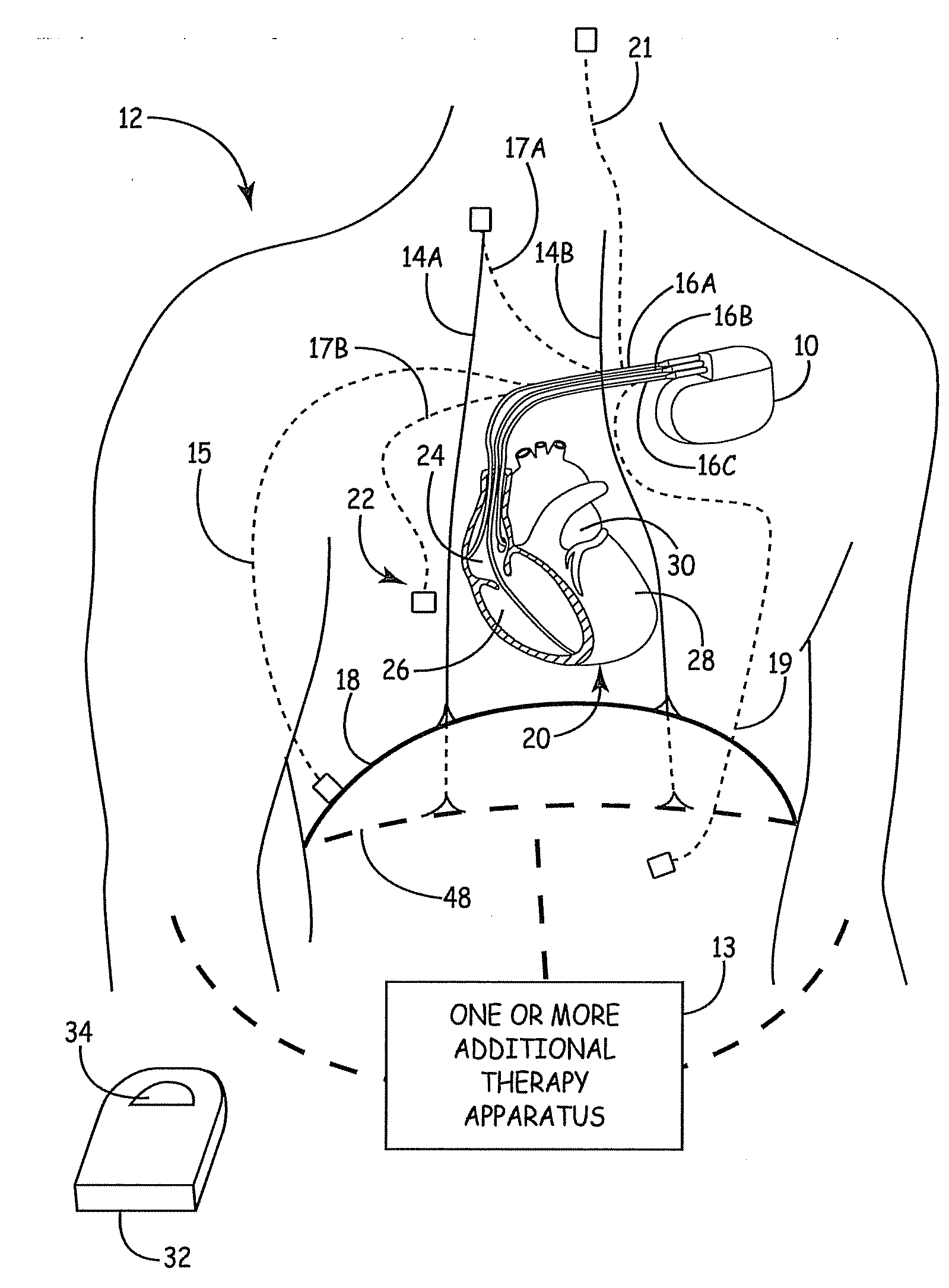 Medical device to provide breathing therapy