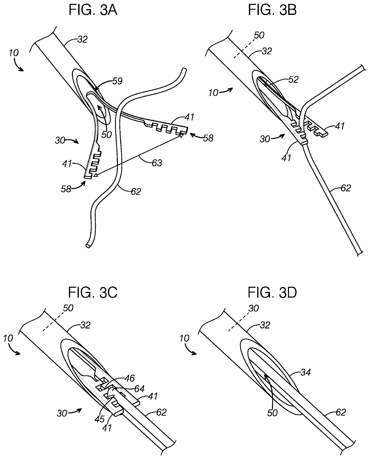 Suture passing device
