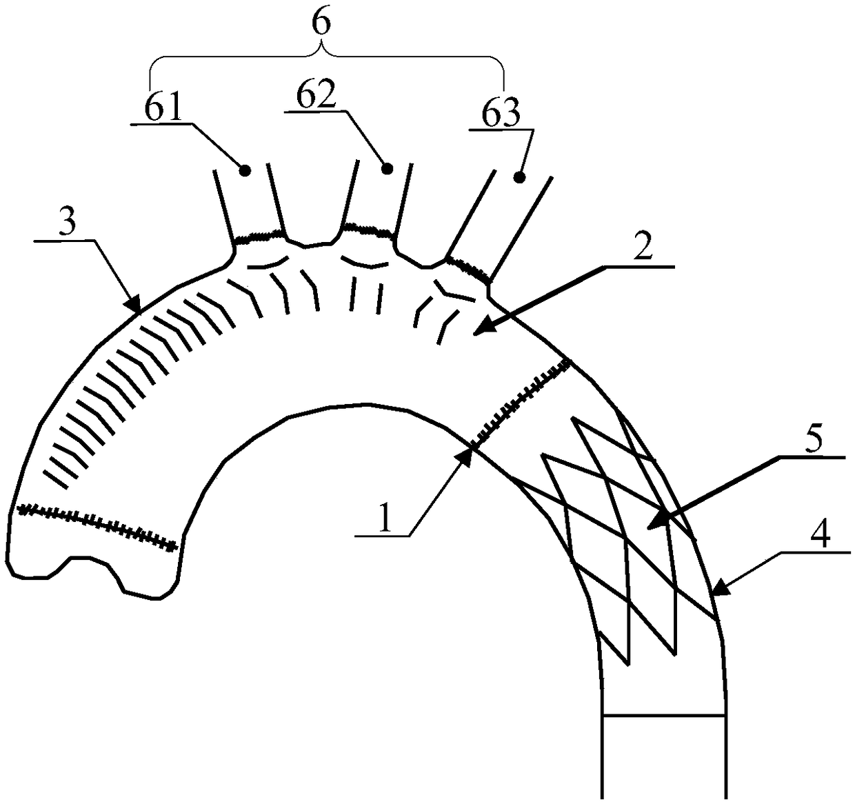 Intraoperative stent delivery system and intraoperative stent system