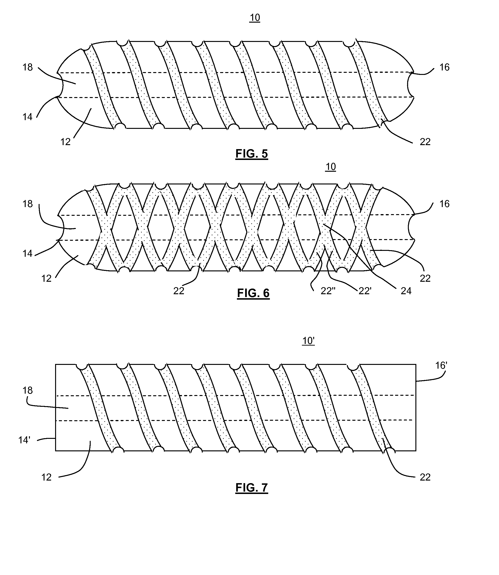 Shape memory tubular stent with grooves