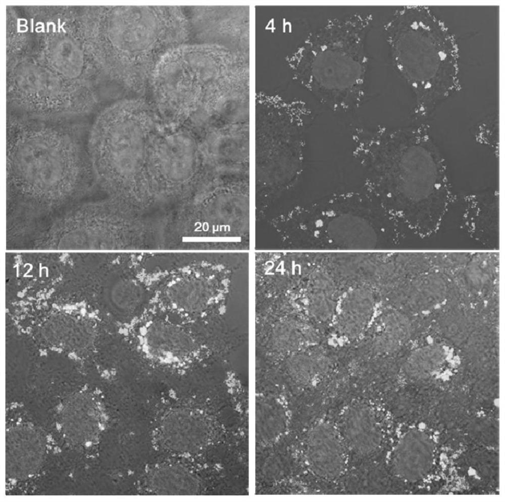 A kind of nanoparticle and its preparation method and application